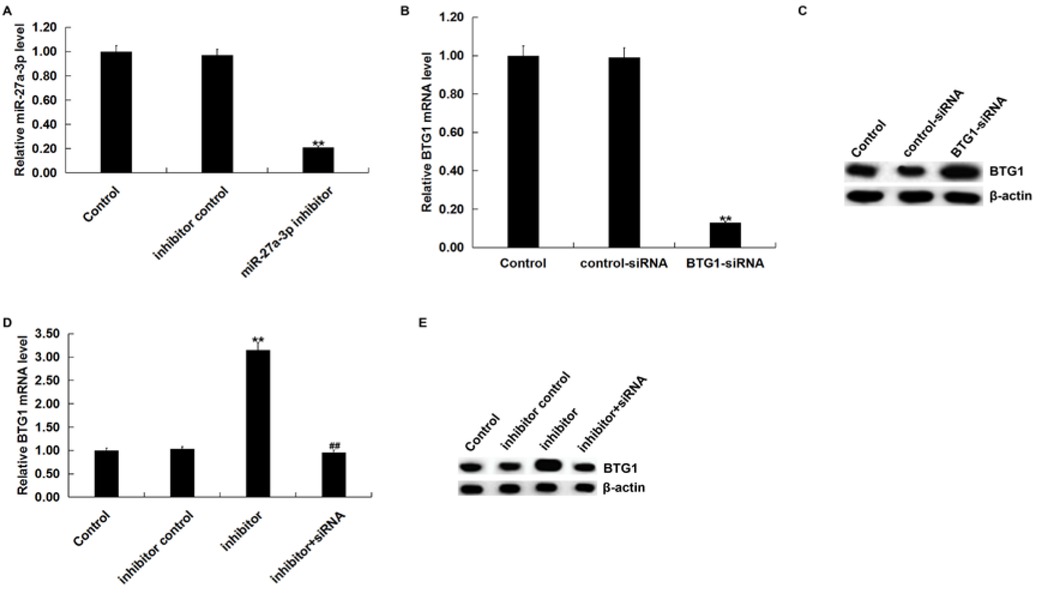 Figure 3 BTG1 was negatively regulated by miR-27a-3p(A) The expression of miR-27a-3p was detected using qRT-PCR after SK-OV-3 cells were transfected with inhibitor control or miR-27a-3p inhibitor for 48 h. qPCR assay (B) and western blot assay (C) detected the expression of BTG1 after SK-OV-3 cells were transfected with control-siRNA or BTG1-siRNA for 48 h. qPCR assay (D) and western blot assay (F) that the expression of BTG1 after SK-OV-3 cells were transfected with inhibitor control, miR-27a-3p inhibitor or miR-27a-3p inhibitor+BTG1-siRNA for 48 h. Control: SK-OV-3 cells without any treatment; inhibitor control: SK-OV-3 cells transfected with inhibitor control; inhibitor/miR-27a-3p inhibitor: SK-OV-3 cells transfected with miR-27a-3p inhibitor; control-siRNA: SK-OV-3 cells transfected with control-siRNA; BTG1-siRNA: SK-OV-3 cells transfected with BTG1-siRNA; inhibitor+siRNA: SK-OV-3 cells transfected with miR-27a-3p inhibitor+BTG1-siRNA. The data were shown as the mean ± SD. **p<0.01 vs. Control. ##p<0.01 vs. inhibitor.