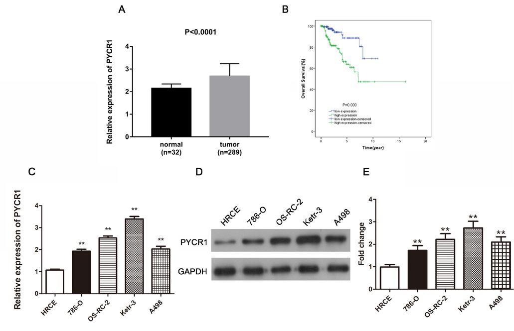 Figure 1 PYCR1 is promoted in PRCC tissues and cells, meanwhile up-regulated PYCR1 is related to poor prognosis in PRCC patients. (A) The relative expression of PYCR1 in PRCC tissues compared to normal tissues. (B) The overall survival curve in PRCC patients with high and low expression of PYCR1. (C) and (D) Comparison of PYCR1 expression in diverse cell lines through qRT-PCR and western blot analyses. (E) The quantification of protein expression level. All the data are expressed as mean ± SD and each test was performed in three times. (**P < 0.01). Supplement Figure 1: The correlation between PYCR2/PYCR3 expression and PYCR1 expression or survival rates of PRCC patients. (A) PYCR2 was over expressed in PRCC tissues consisting of 32 normal cases and 289 PRCC cases. (B) Survival curve showed the connection between PYCR2 expression and PRCC. (C) PYCR3 was increased in PRCC tissues including 32 normal cases and 289 PRCC cases. (D) The survival curves analysis on the basis of PYCR3 expression. (E) and (F) PYCR1 expression was closely linked with PYCR2/PYCR3 by the Pearson’s analyses.