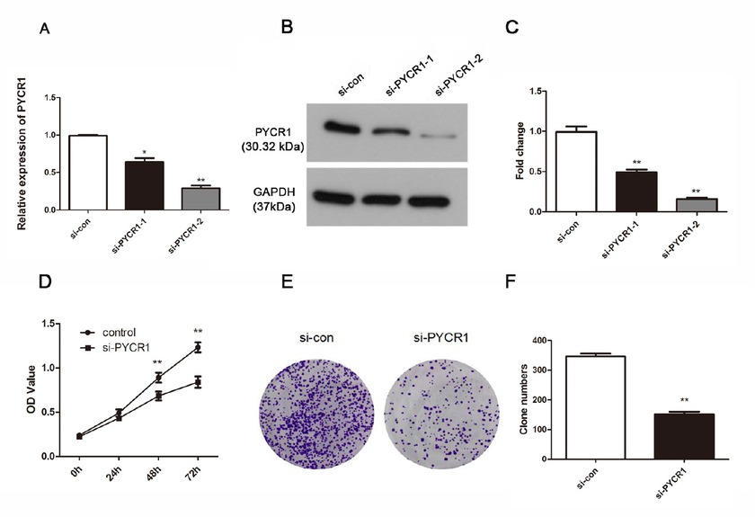 Figure 2 SiRNA strategy suppresses the PYCR1 expression successfully and retards cell viability in Ketr-3 cells. (A and B) The effective rates were detected by qRT-PCR analysis and western blot. (C) The fold change of western blot results. (D) Cell proliferation was measured using CCK-8 assay. (E) Colony formation was measured and (F) the number of clone was counted. The data are expressed as mean ± SD in triplicates. (*P < 0.05, **P < 0.01)