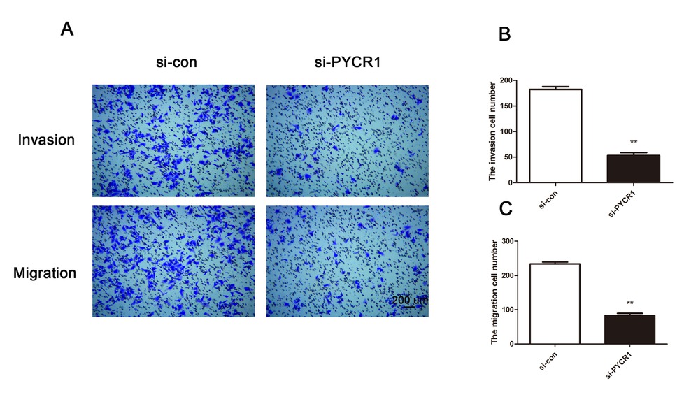 Figure 3 PYCR1 knockdown inhibits cell migration and invasion in Ketr-3 cells. (A) Transwell assays showed the difference of cell migration and invasion between si-con group and si-PYCR1 group. (B) and (C) The migratory and invasive cells were calculated. Bar = 200 μm. Every experiment was conducted three times. (**P < 0.01)