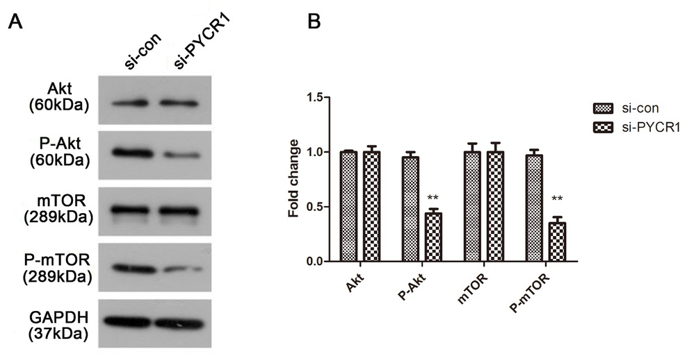 Figure 4 Silenced PYCR1 has a negative role on Akt/mTOR pathway in PRCC. (A) The expression level of Akt, p-Akt, mTOR and p-mTOR, with GAPDH considered as control. (B) Relative protein expression was quantified and depicted in column diagram. All the tests were carried out in triplicates independently. (**P < 0.01)