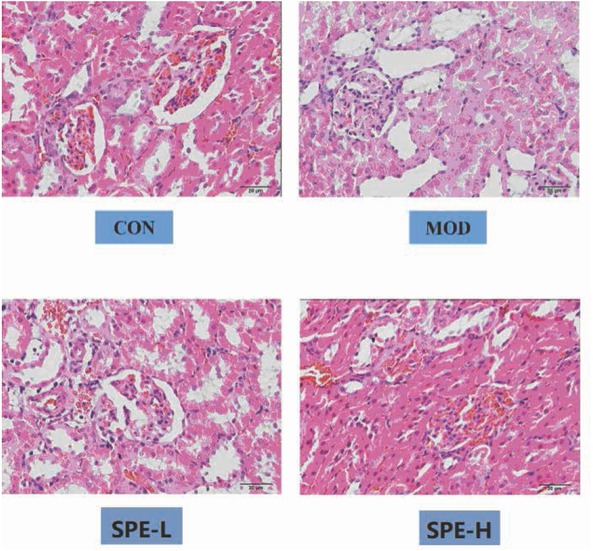 Figure 1 HE staining indicating the pathological changes in renal tissues. CON, control; MOD: model group; SPE-L, low dose group of SPE; SPE-H, high dose group of SPE.