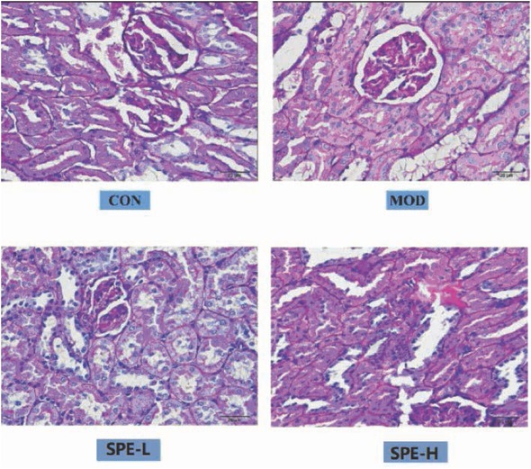 Figure 2 PAS staining for the pathological changes in renal tissues. CON, control; MOD: model group; SPE-L, low dose group of SPE; SPE-H, high dose group of SPE.