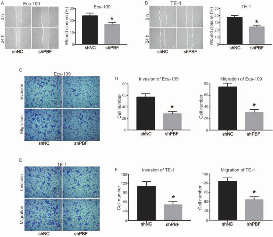 Figure 2 Down-regulation of PBF inhibits cell invasion and migration of ESCA. The ability of wound closure in (A) Eca-109 and (B) TE-1 cells was detected by scratch assay; bar = 1 mm (C) The images of invasive and migrated Eca-109 cells transfected by shNC or sh2-PBF for 48 h; bar = 100 μm. (D) Quantitative results of cell migration and invasion in Eca-109; (E) The image of invasive and migrated TE-1 cells transfected by shNC or sh2-PBF for 48 h; bar = 100 μm. (F) Quantitative results of cell migration and invasion in TE-1. All experiments were repeated 3 times. *P represented significant difference.