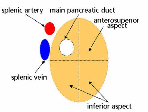 Figure 3 The safe region of pancreatic RFA is the anterosuperior and inferior aspects of the pancreas.
