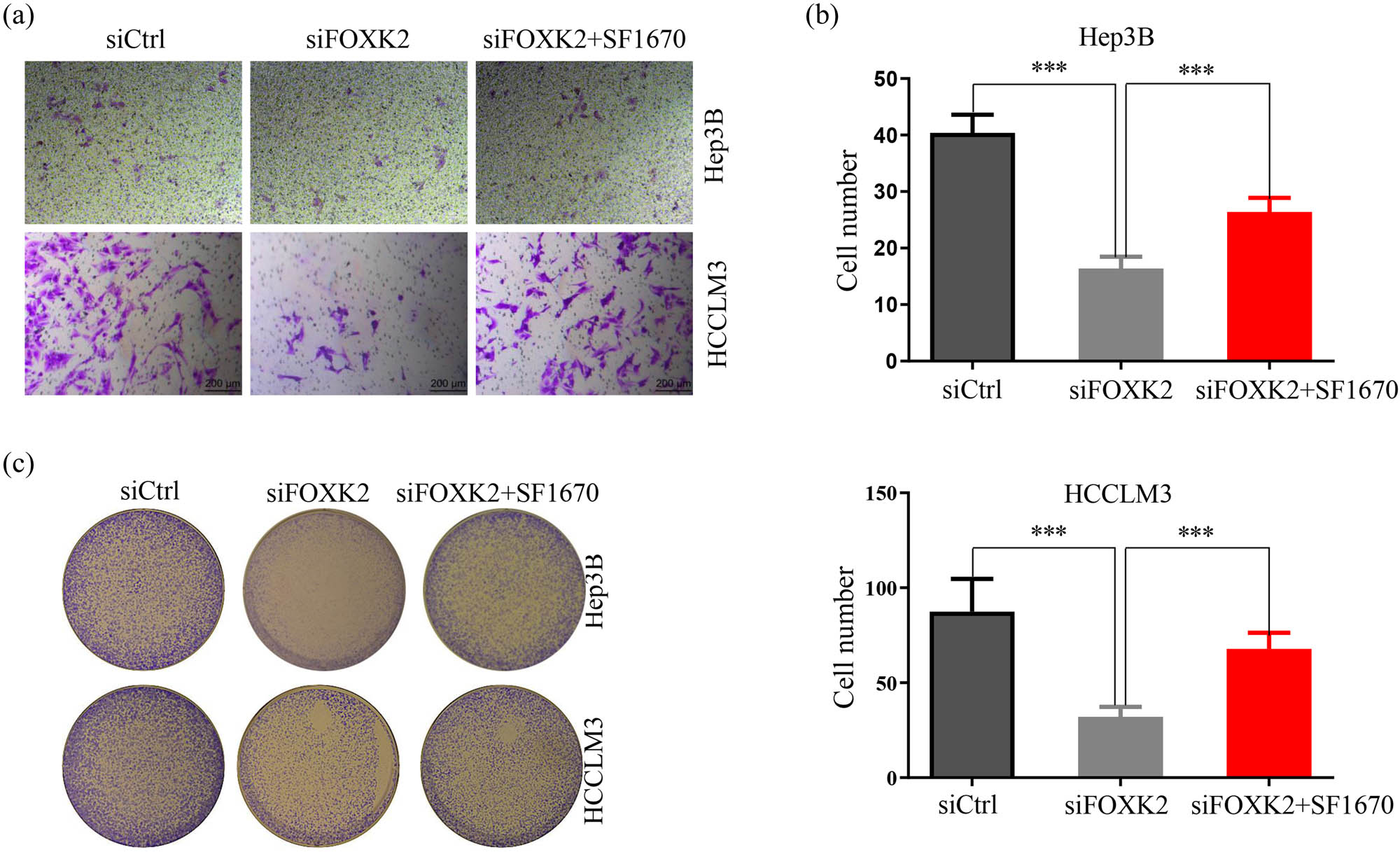 Figure 4 Akt activation blocked the effect of FOKK2 inhibition on HCC cells. FOXK2 knockdown dramatically inhibited the invasion (a and b) and colony formation (c) of Hep3B or HCCLM3 cells and SF1670 partly inhibited the effect of FOXK2 suppression on HCC cells. These data are representative of at least three independent experiments. ***P < 0.001.