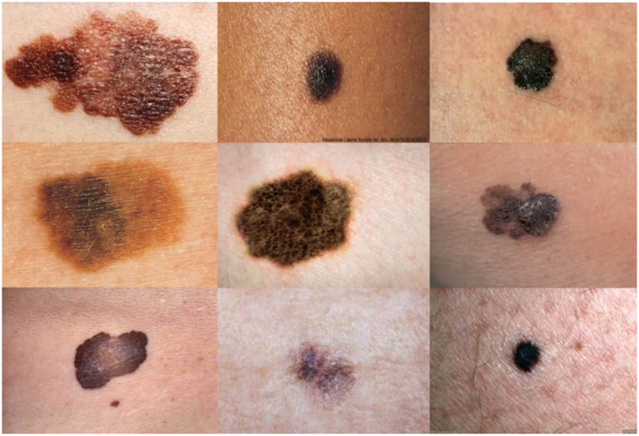 Figure 5 Some examples of the used dataset from ACS.