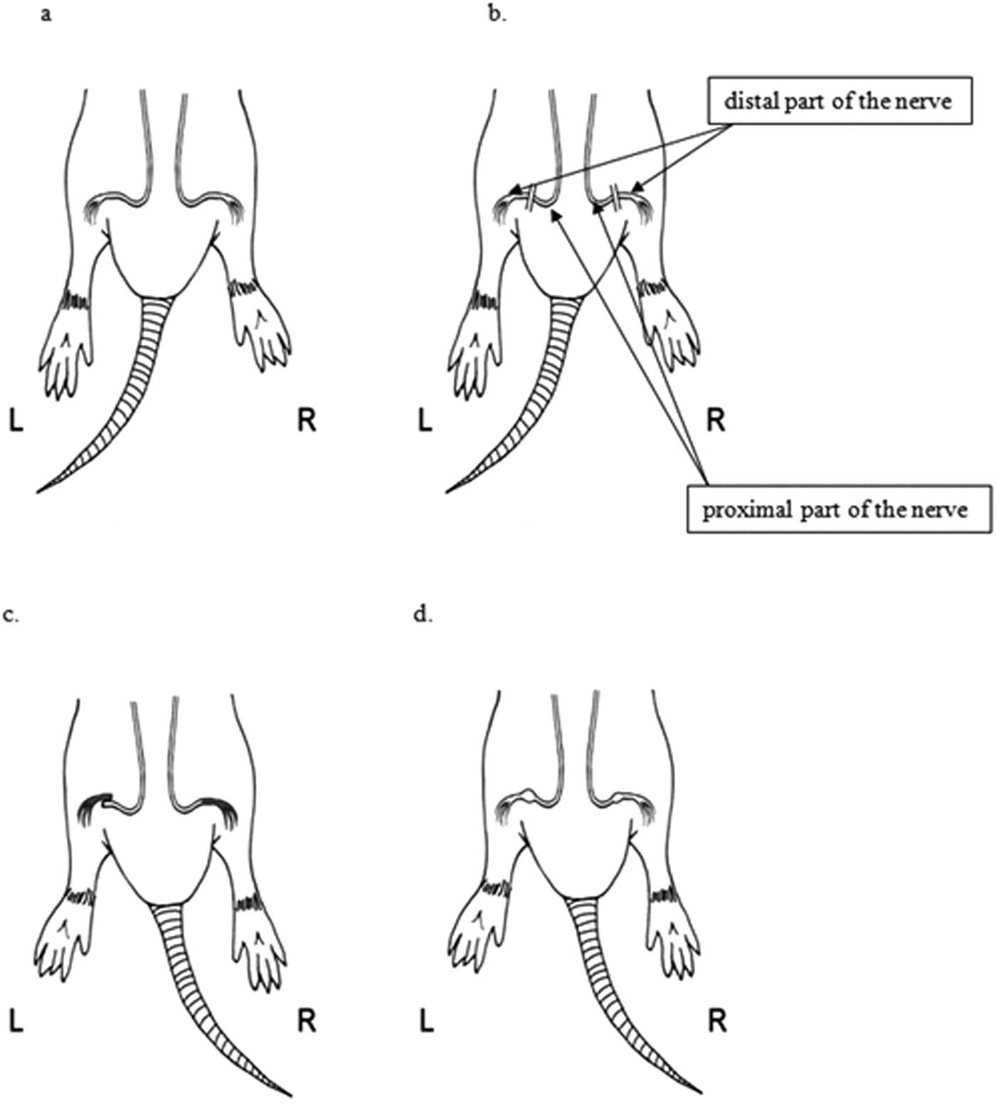 Figure 1 The schematic representation of (a) exposure of sciatic nerves, (b) transecting the nerves, (c) anastomosis L (left side) side-to-side, R (right side) end-to-end, and (d) follow-up after 4 weeks.