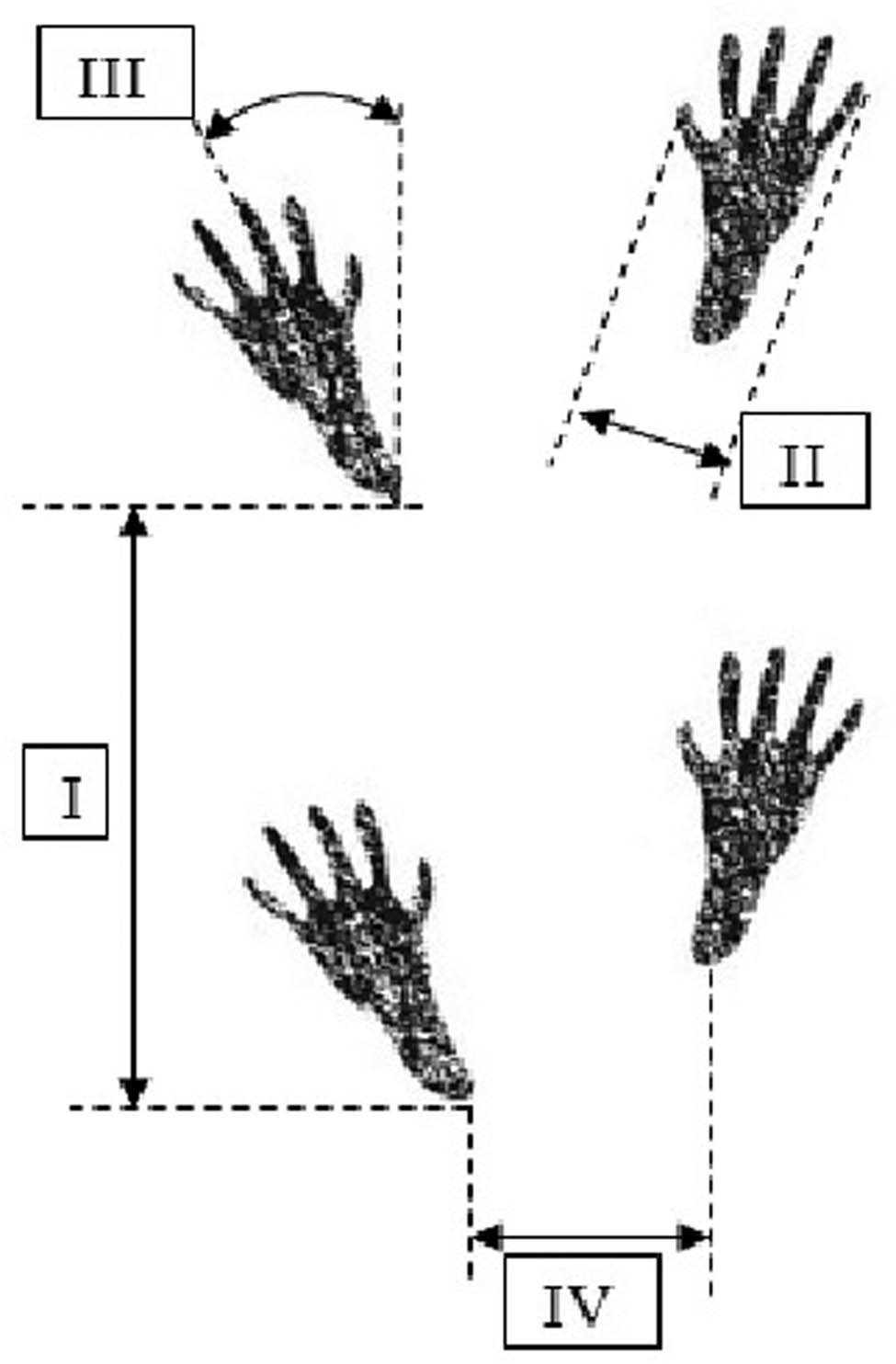 Figure 2 The a schematic representation of gait assessment based on the measurements of the hind paw prints: (I) step length, (II) digit spread (between digits I–V), (III) foot deviation (angle between the foot axis and the walking axis), and (IV) step width (distance between the left heel and the right heel).