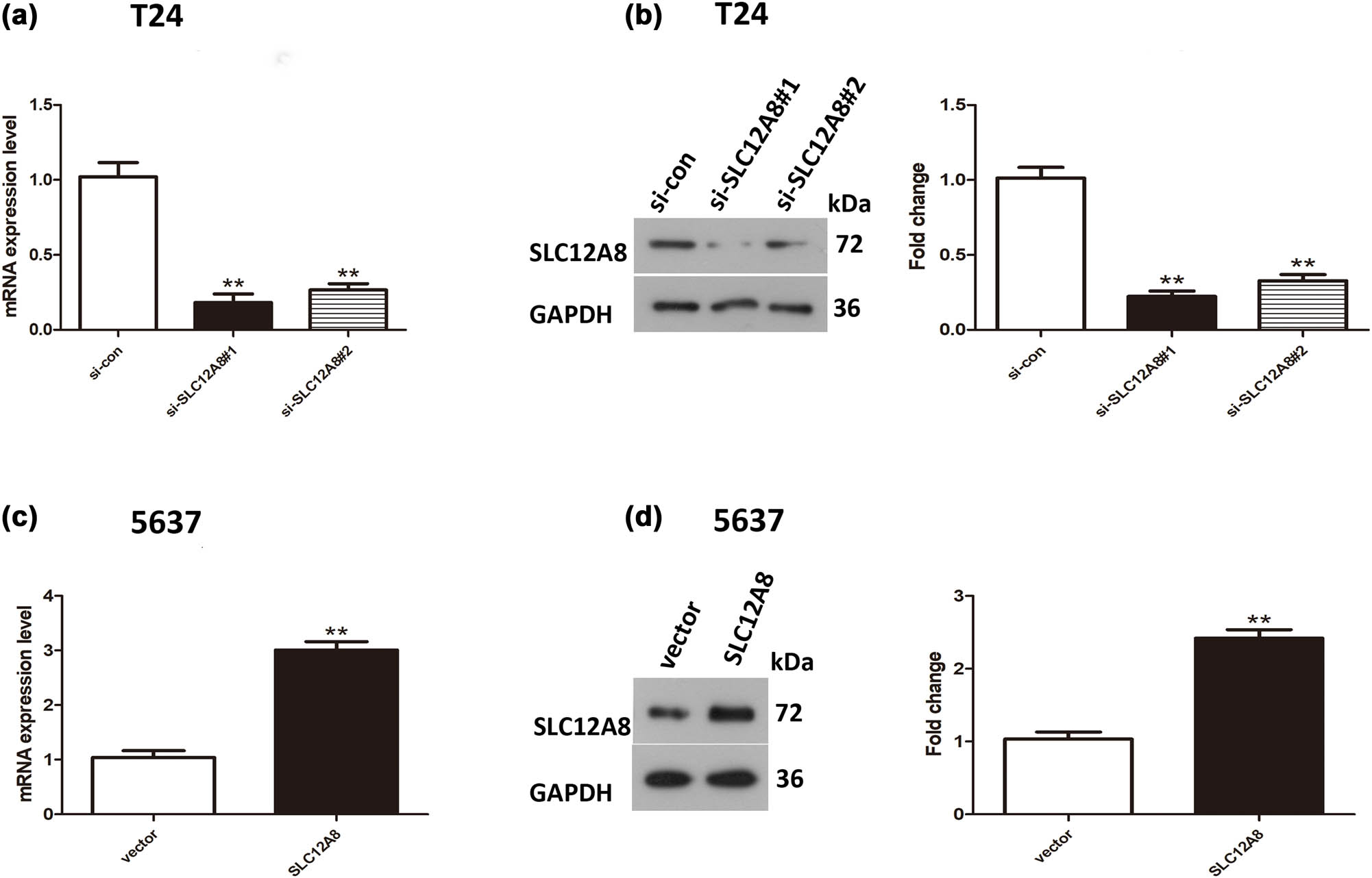 Figure 2
Expression of SLC12A8 mRNA and protein in bladder cancer cells transfected with si-SLC12A8 or pcDNA3.1-SLC12A8. (a) The SLC12A8 mRNA expression levels were decreased in T24 cells after transfection with si-SLC12A8#1 or si-SLC12A8#2, **p < 0.01. (b) The SLC12A8 protein expression was decreased in T24 cells with depleted SLC12A8, **p < 0.01. (c) The mRNA-SLC12A8 expression level was remarkably increased in 5,637 cells with upregulated SLC12A8, **p < 0.01. (d) The SLC12A8 protein expression was notably higher in 5,637 cells with upregulated SLC12A8, **p < 0.01.