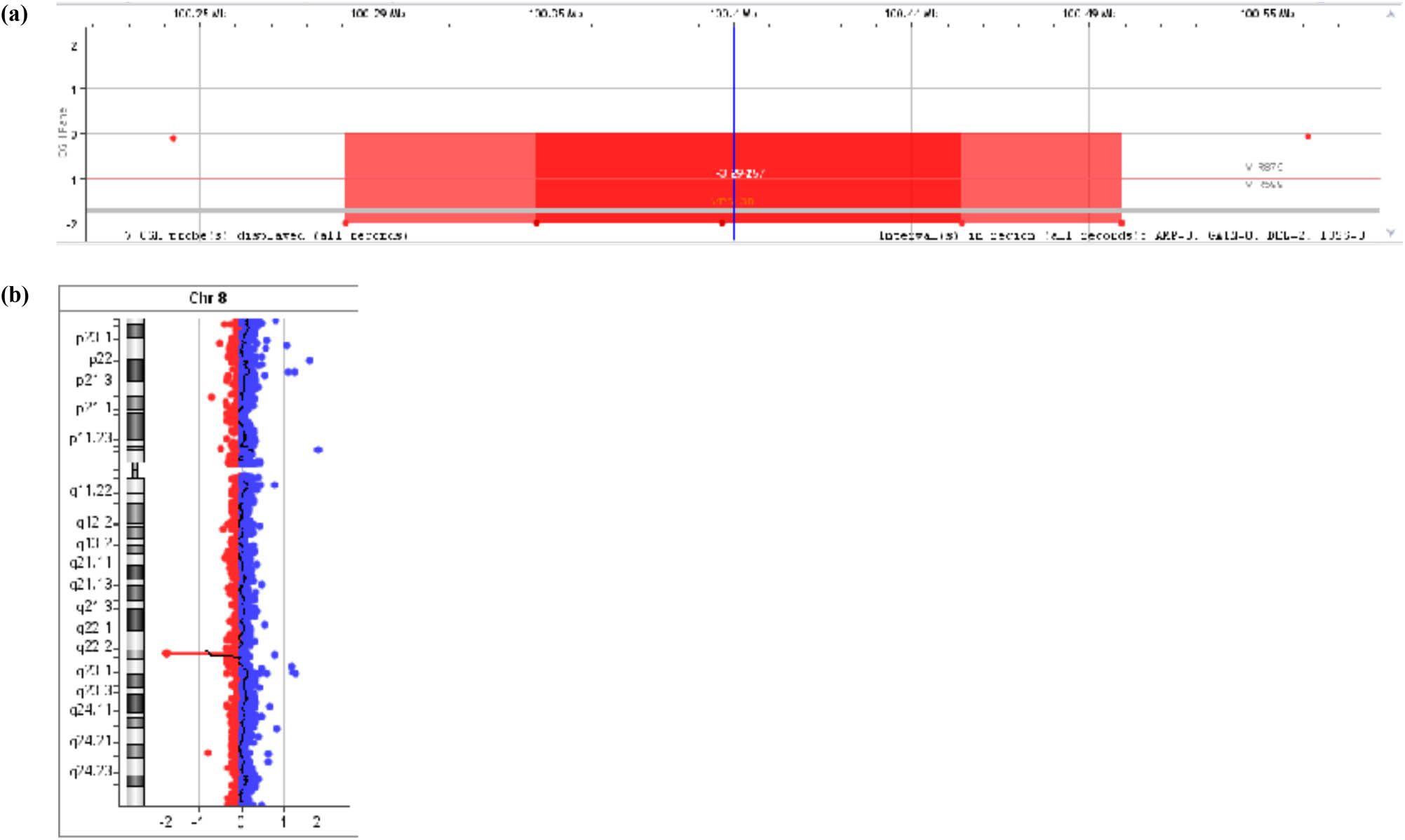Figure 1 
               (a) and (b) Results of a CGH analysis pointing a partial loss of both copies of genetic material at the VPS13B gene: 8q22.2(100290888_100508951)x0 (Agilent Technologies SurePrint G3 ISCA V2 CGH 8x60K [hg19]).
            