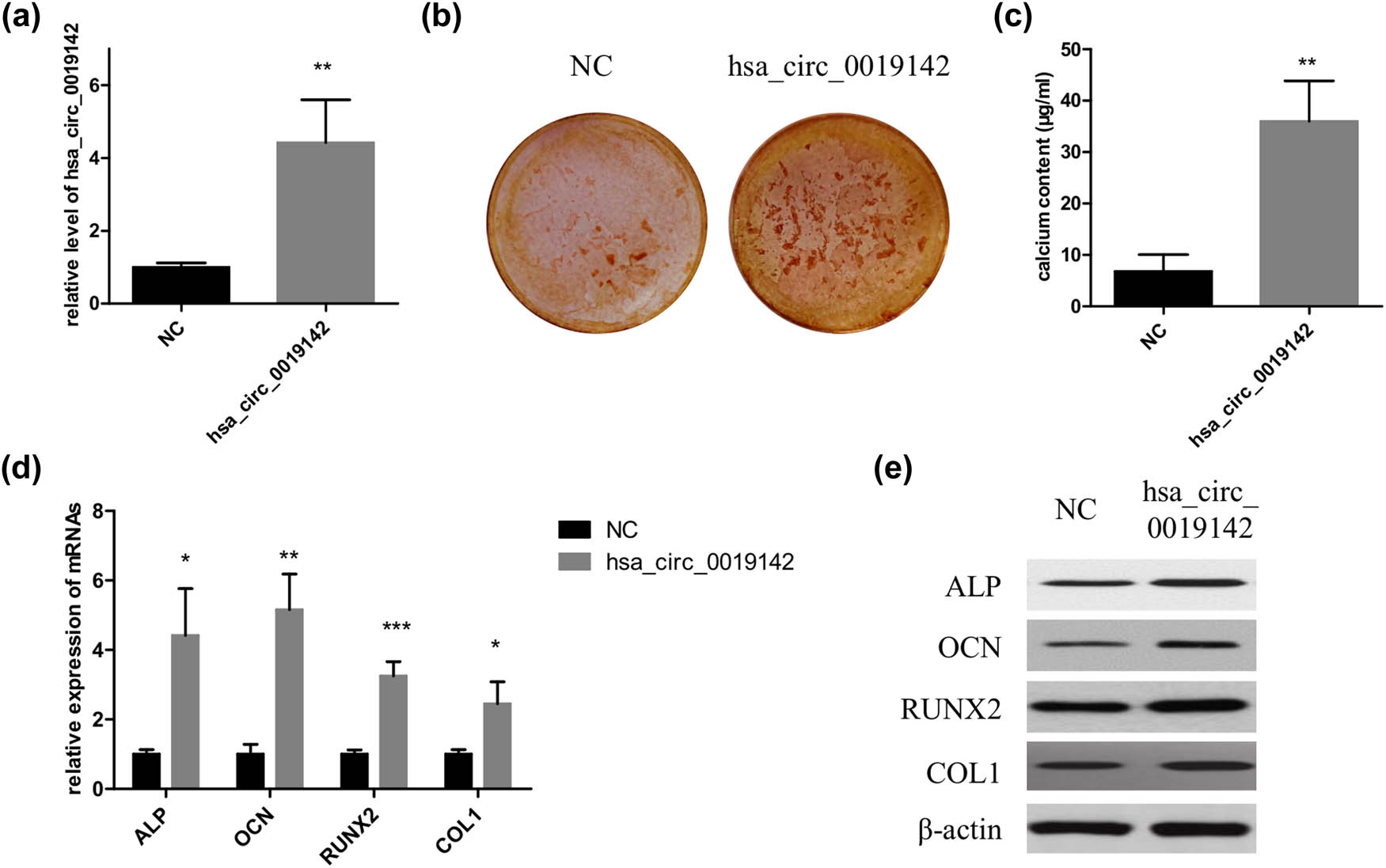 Figure 4 
                  Overexpression of hsa_circ_0019142 promotes osteogenic differentiation of hADMSCs. (a) qPCR verification of the level of hsa_circ_0019142 in cells overexpressing it. After the induction of osteogenesis in the hsa_circ_0019142 overexpressed cells in the culture plate, the cells were used for ARS staining (b), calcium concentration analyses (c), and detection of relative mRNA (d) and protein levels of ALP, OCN, RUNX2, and COL1 (e) (n = 3 in each experiment). NC, negative control; ARS, Alizarin red S. *P < 0.05, **P < 0.01, and ***P < 0.001.
               