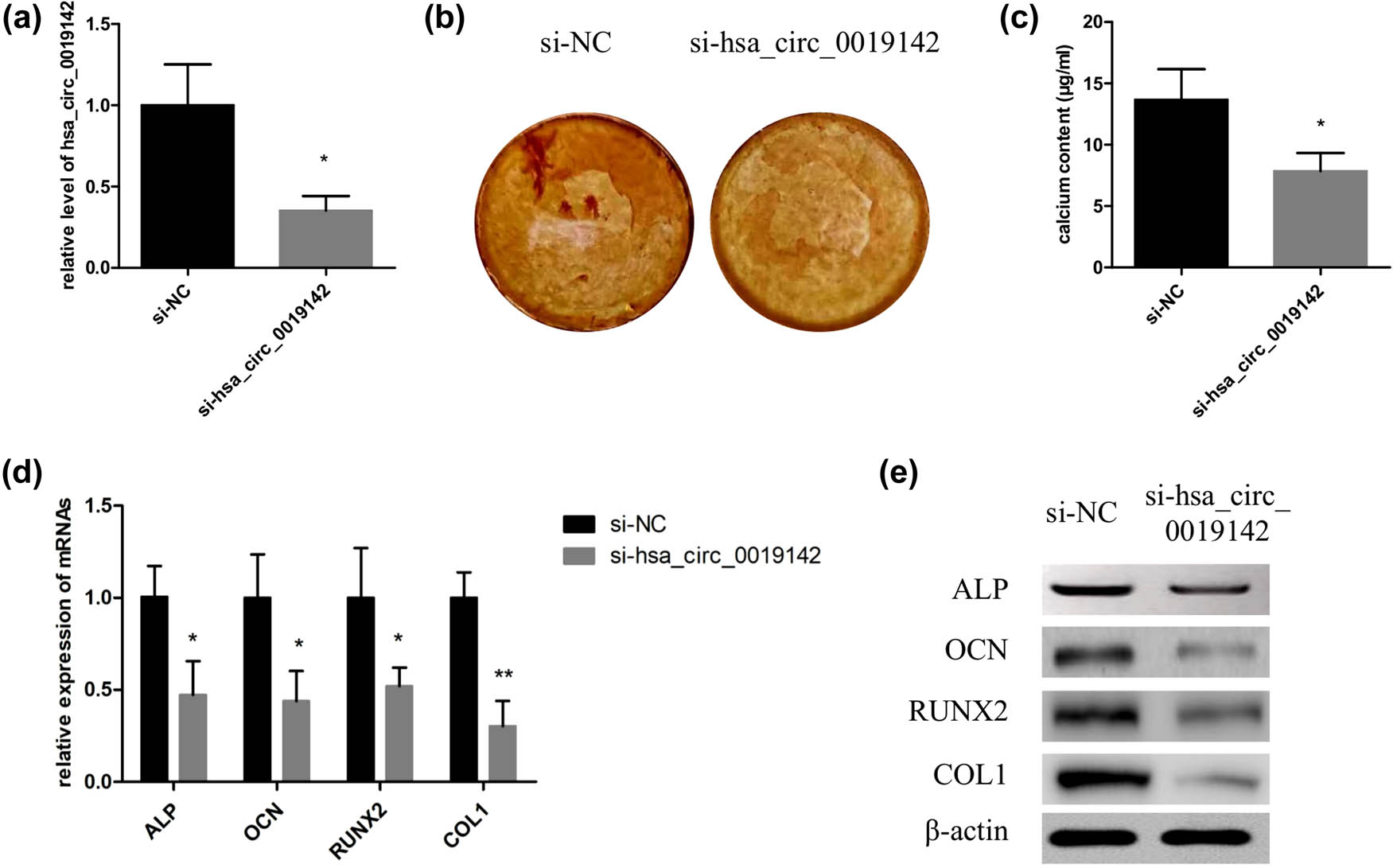 Figure 5 
                  Knockdown of hsa_circ_0019142 inhibits osteogenic differentiation of hADMSCs. (a) qPCR verification of the level of hsa_circ_0019142 in cells silencing it. After the induction of osteogenesis in the hsa_circ_0019142 silenced cells in the culture plate, the cells were used for ARS staining (b), calcium concentration analyses (c), and detection of relative mRNA (d) and protein levels of ALP, OCN, RUNX2, and COL1 (e) (n = 3 in each experiment). NC, negative control; ARS, Alizarin red S. *P < 0.05 and **P < 0.01.
               