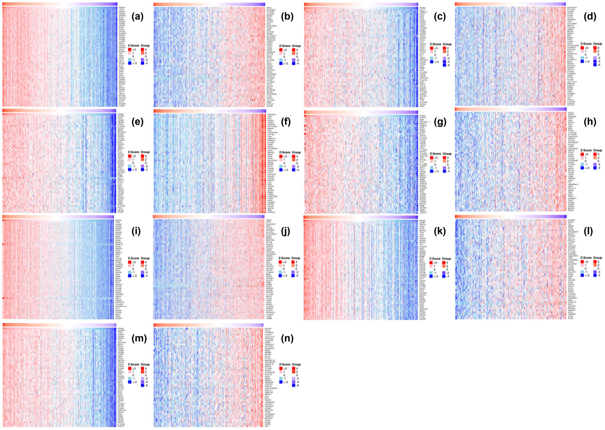 Figure 6 
                  Heat map of co-expressed genes with KPAN2 in six major cancers. (a) Positive co-expressed genes with KPAN2 in lung adenocarcinoma, (b) negative co-expressed genes with KPAN2 in lung adenocarcinoma, (c) positive co-expressed genes with KPAN2 in lung squamous carcinoma, (d) negative co-expressed genes with KPAN2 in lung squamous carcinoma, (e) positive co-expressed genes with KPAN2 in gastric cancer, (f) negative co-expressed genes with KPAN2 in gastric cancer, (g) positive co-expressed genes with KPAN2 in colorectal cancer, (h) negative-expressed genes with KPAN2 in colorectal cancer, (i) positive co-expressed genes with KPAN2 in breast cancer, (j) negative co-expressed genes with KPAN2 in breast cancer, (k) positive co-expressed genes with KPAN2 in liver hepatic cancer, (l) negative co-expressed genes with KPAN2 in breast cancer, (m) positive co-expressed genes with KPAN2 in bladder cancer, (n) negative co-expressed genes with KPAN2 in bladder cancer.
               