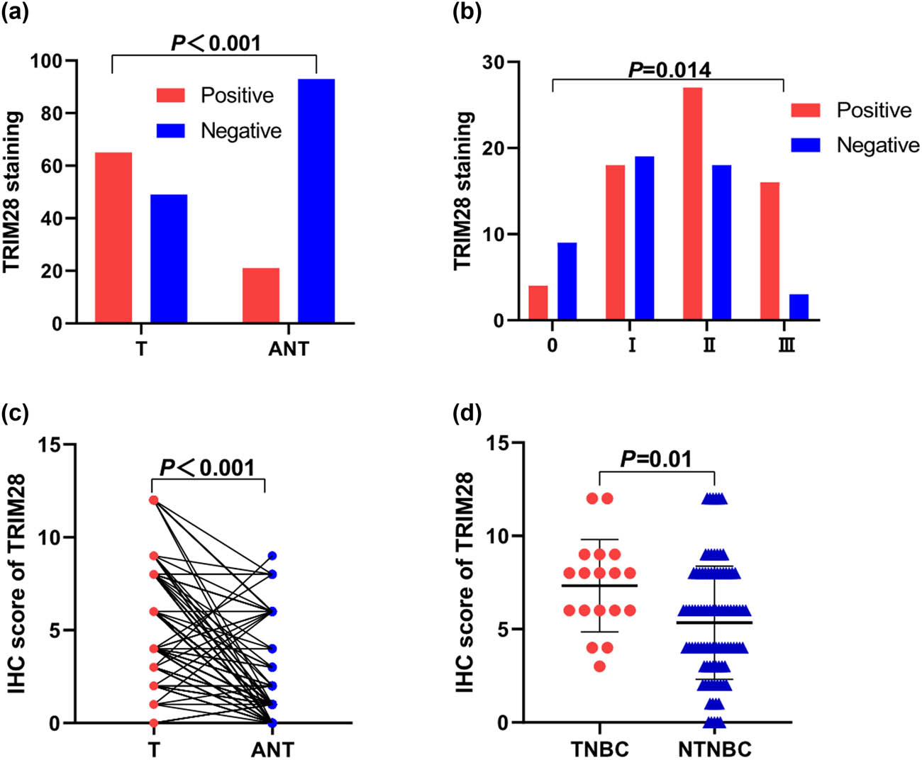 Figure 2
The IHC staining of TRIM28 expression in tissues. (a) The comparison of the percentage of positive TRIM28 staining in tissues between tumors and ANTs (P < 0.001). (b) The distribution of positive TRIM28 staining at different TNM stages (P = 0.014). (c) The IHC score of TRIM28 in cancer and adjacent tissues (P < 0.001). (d) The IHC score of TRIM28 in triple-negative breast cancer and non-triple-negative breast cancer (P = 0.01). ANT: adjacent normal tissue; T: tumor; TNBC: triple-negative breast cancer; NTNBC: non-triple-negative breast cancer.