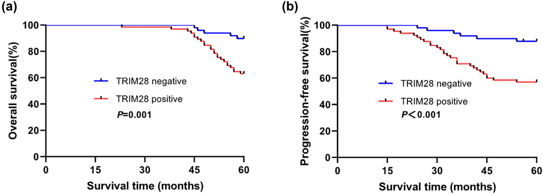 Figure 4
Kaplan-Meier survival analysis of high TRIM28 expression (n = 49) and low TRIM28 expression (n = 65) in BC patients. (a) The relationship between TRIM28 expression and overall survival rate (P = 0.001); (b) The relationship between TRIM28 expression and progression-free survival rate (P < 0.001).