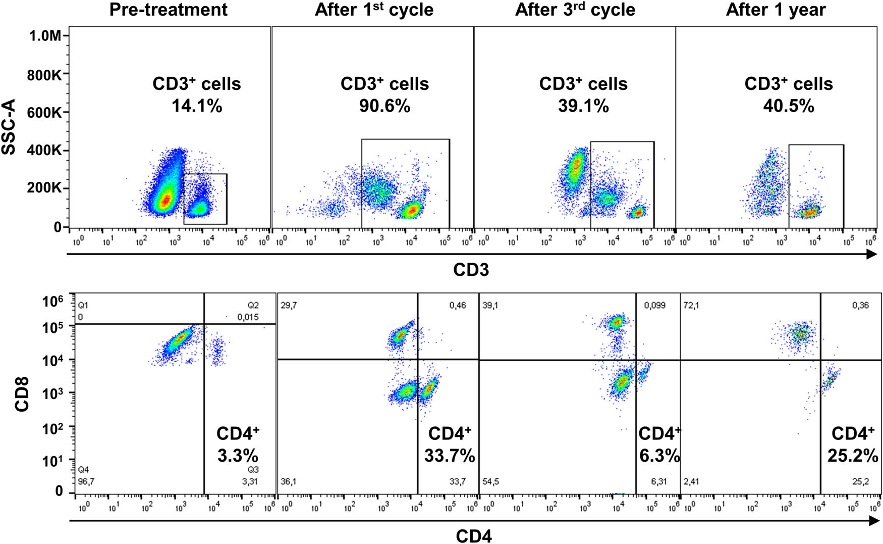 Figure 1 
                  Flow cytometry gating strategy. After post-acquisition compensation using FlowJo, cell populations were first identified using linear parameters (forward scatter area [FSC-A] vs side scatter area [SSC-A], and double cells were excluded (FSC-A vs FSC-W)). On single cells, CD3+ cells were identified (CD3 vs SSC-A), and CD4 and CD8 expression was further studied. Flow cytometry analysis of a representative patient who experienced CMV reactivation is reported before starting treatment, after the first cycle of RDB and the third, and then after one year. Percent of CD3+ and CD4+ cells is shown for each timepoint.
               