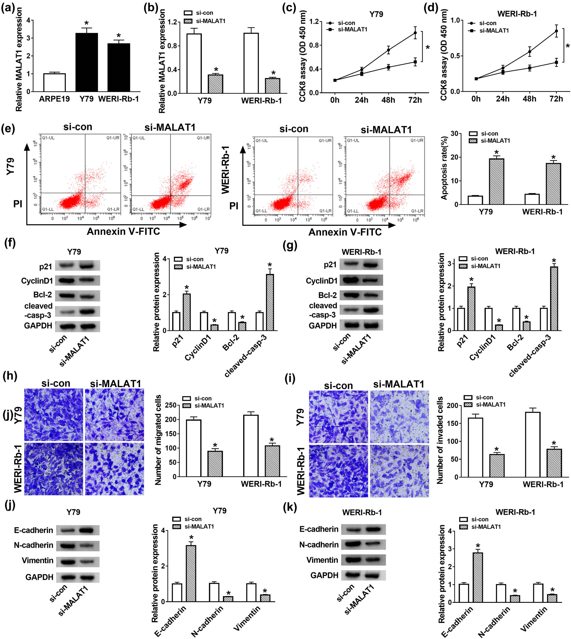 Figure 2 
                  MALAT1 depletion suppressed cell proliferation but induced apoptosis and EMT in Y79 and WERI-Rb-1 cells. (a) The expression of MALAT1 in RB cells (Y79 and WERI-Rb-1) and retinal pigment epithelial cell ARPE19 was detected by RT-qPCR. (b–k) Y79 and WERI-Rb-1 cells were transfected with si-NC or si-MALAT1. (b) The expression of MALAT1 in Y79 and WERI-Rb-1 cells was examined by RT-qPCR after transfection for 24 h. (c and d) The cell viability was detected by CCK-8 assay after transfection for 0, 24, 48, and 72 h. (e) The apoptosis rate was assessed by flow cytometry after transfection for 48 h. (f and g) The protein levels of p21, Cyclin D1, Bcl-2, and cleaved-casp-3 were detected by western blot after transfection for 48 h. (h and i) After transfection for 24 h, cell migration and invasion were detected by transwell assay. (j and k) The protein levels of E-cadherin, N-cadherin, and Vimentin were examined by western blot after transfection for 48 h. *P < 0.05.
               