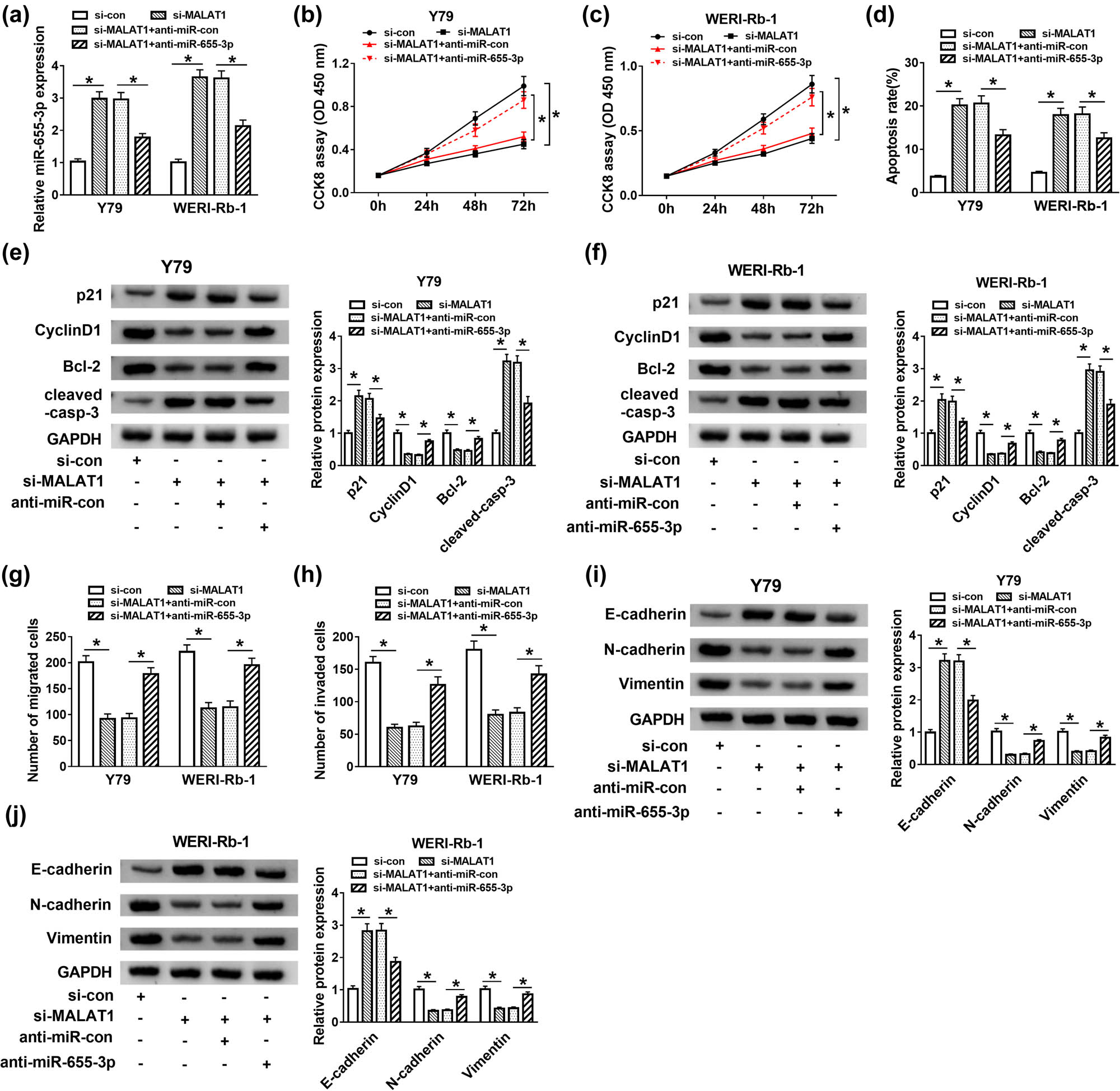 Figure 4 
                  MALAT1 regulated RB progression by sponging miR-655-3p. (a–j) The Y79 and WERI-Rb-1 cells were transfected with si-con, si-MALAT1, si-MALAT1 + anti-miR-con, or si-MALAT1 + anti-miR-655-3p. (a) The level of miR-655-3p was measured by RT-qPCR after transfection for 24 h. (b and c) The cell viability was examined by CCK8 assay after transfection for 0, 24, 48, and 72 h. (d) The apoptosis rate was evaluated through flow cytometry after transfection for 48 h. (e and f) The protein levels of p21, Cyclin D1, Bcl-2, and cleaved-casp-3 were tested via western blot assay after transfection for 48 h. (g and h) The migration and invasion abilities were estimated by transwell assay after transfection for 24 h. (i and j) After transfection for 48 h, the protein levels of E-cadherin, N-cadherin, and Vimentin were detected by western blot. *P < 0.05.
               