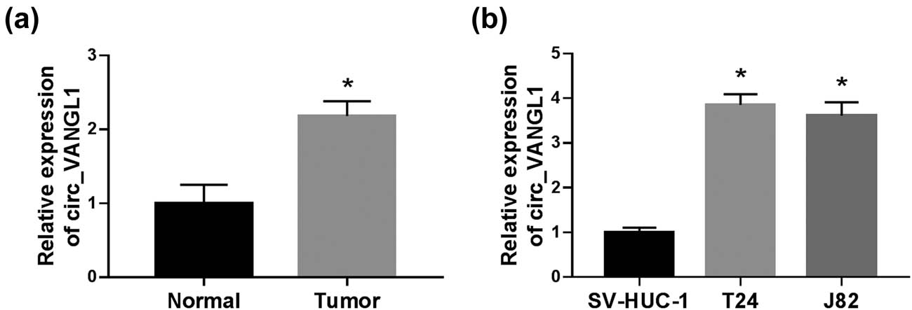 Figure 1 
                  The level of circ_VANGL1 in bladder cancer tissues and cells. (a) RT-qPCR was used to detect the level of circ_VANGL1 in tumor tissues (n = 36) and matched normal tissues (n = 36). (b) The level of circ_VANGL1 in bladder cancer cells (T24 and J82) and human normal bladder epithelial cell line (SV-HUC-1) was measured by RT-qPCR. *P < 0.05.
               