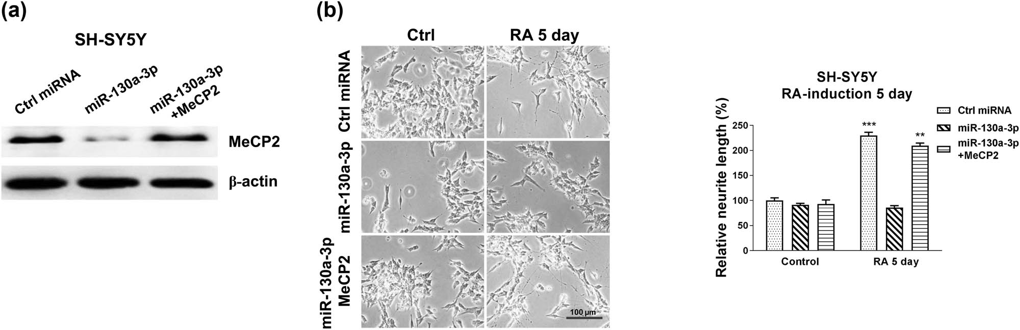 Figure 5 
                  Restoration of MeCP2 rescues the miR-130a-3p suppressed neuron differentiation. (a) SH-SY5Y cells were transfected with control, miR-130a-3p alone, or with MeCP2 overexpression plasmid for 48 h; protein expression of MeCP2 was determined by western blot. (b) The above transfected cells were treated with 5 µM RA for 5 and 7 days. Cell morphologies were examined under a microscope, and the neurite length was measured. *p < 0.05 and **p < 0.01.
               