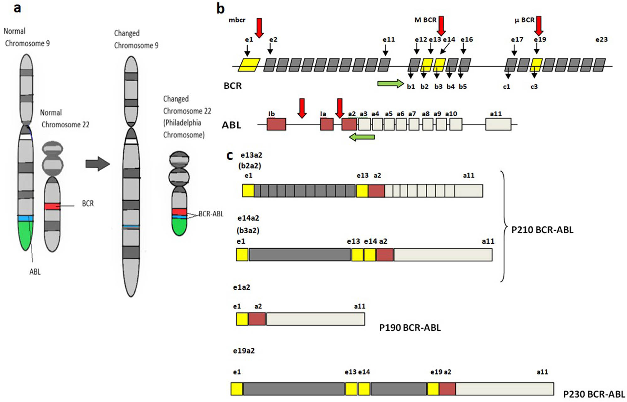 Figure 1
(a) Schematic diagram of the normal structure of chromosome 9 and 22 and translocation between chromosome 9 and 22, resulting in Philadelphia chromosome. (b) Schematic representation of the molecular structure of BCR and ABL genes. Red arrows indicate breakpoints in both genes. Green arrows show the placement of forward and reverse primer on the exons of BCR and ABL for detection of different transcripts by RT-PCR. (c) Schematic diagram of the structure of chimeric mRNA transcribed from different breakpoints of BCR–ABL fusion gene.