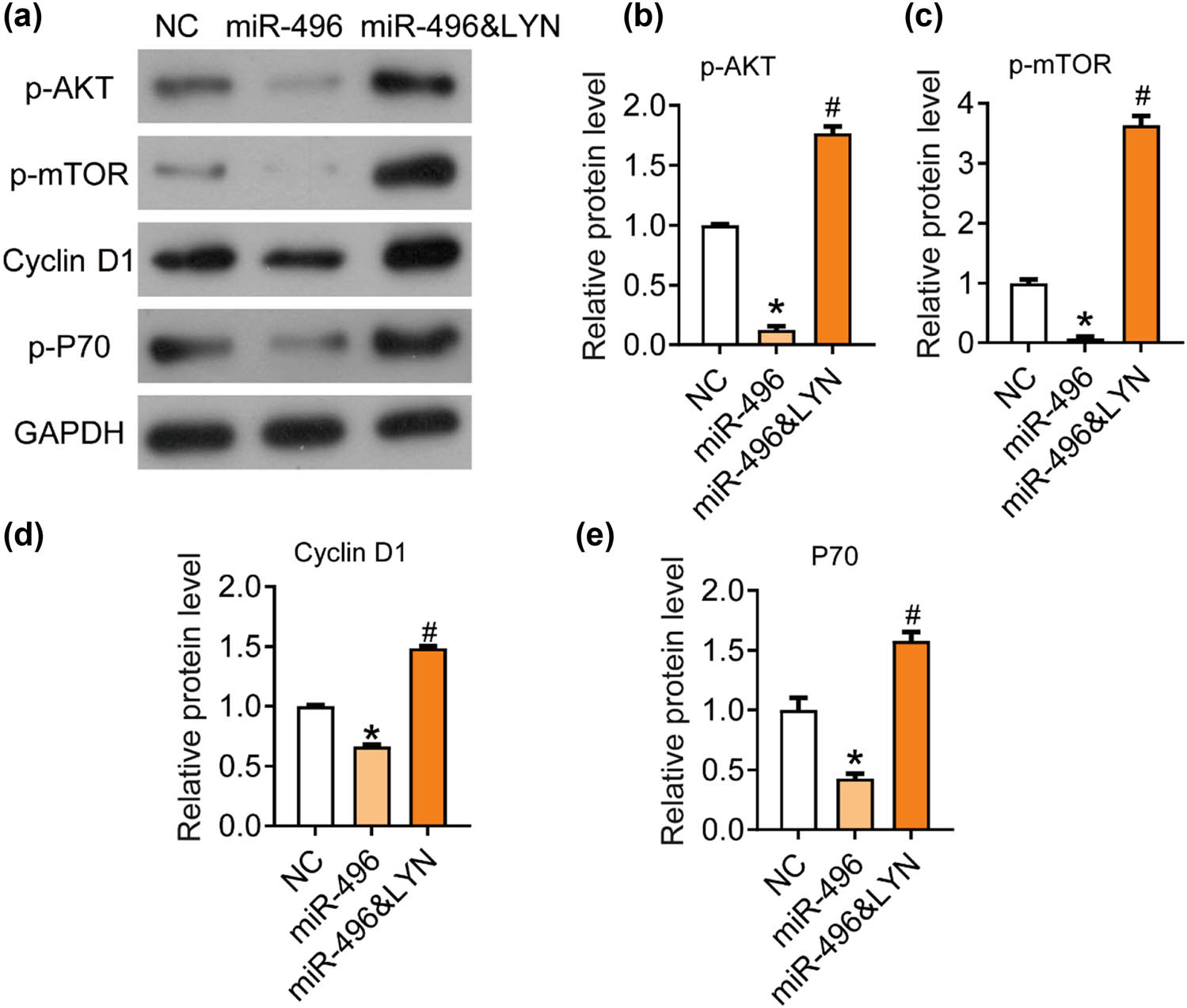 Figure 5
miR-496 inhibited the AKT/mTOR signaling pathway by targeting LYN in gastric cancer cells. (a) The expression levels of AKT/mTOR pathway-related proteins, (b) p-AKT, (c) p-mTOR, (d) Cyclin D1, (e) P70 were detected by western blot. The relative protein levels were normalized to NC group. NC = negative control. *P < 0.05; #
P < 0.05.