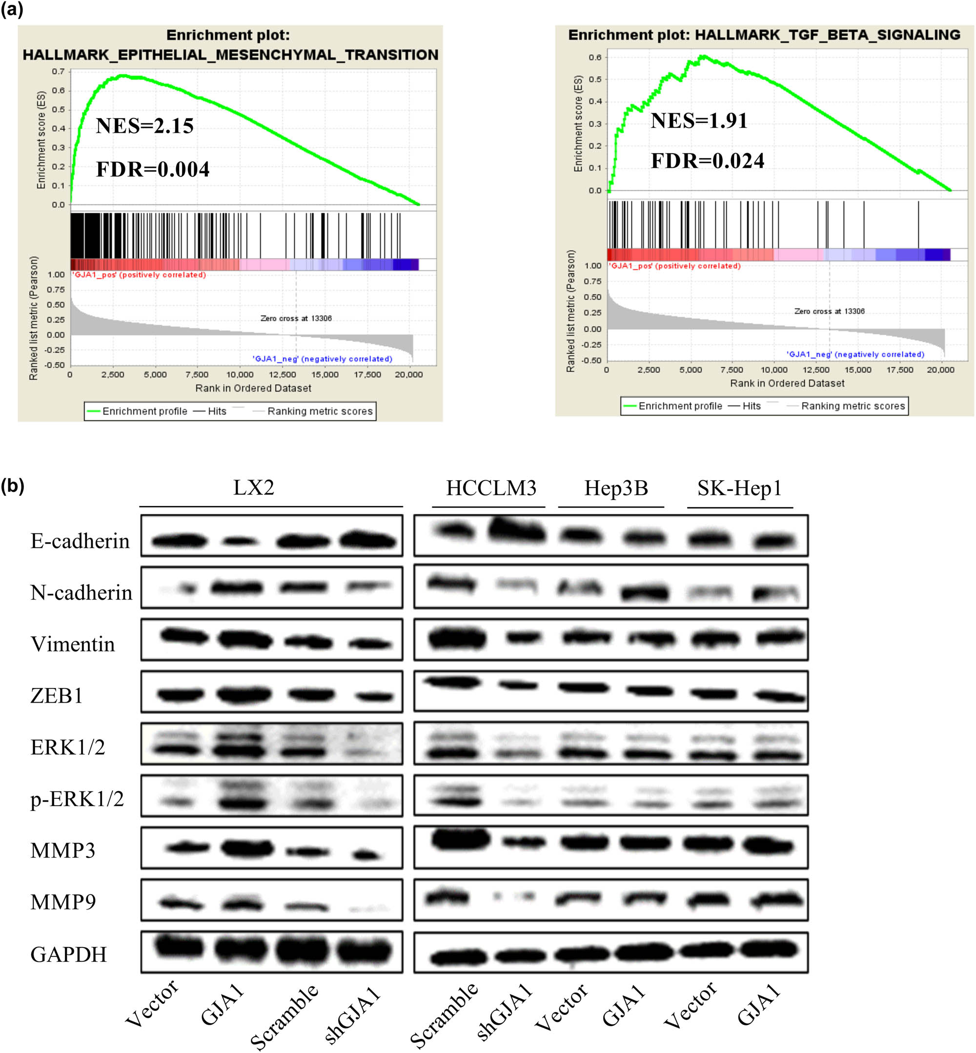 Figure 4 
                  GJA1 induces the EMT. A GSEA indicated that GJA1 expression was positively correlated with the hallmark gene sets EPITHELIAL_MESENCHYMAL_TRANSITION (a, left) and TGF_BETA_SIGNALING (a, right). Cell lysates were collected from LX2 stable infectants expressing GJA1, vector control, shGJA1, or scrambled control cells, followed by western blot analyses with the indicated antibodies (b, left panel). HEP3B and PLC-PRF-5 cells were transduced with lentiviruses carrying GJA1 or vector control, while HCCLM3 cells were transduced with shGJA1 or the scrambled control. Cell lysates were collected and were analyzed using western blotting with the indicated antibodies (b, right panel). EMT, epithelial–mesenchymal transition; ERK, extracellular regulated protein kinases; FDR, false discovery rate; GJA1, gap junction protein, alpha 1; GSEA, Gene Set Enrichment Analysis; MMP, matrix metalloproteinase; NES, normalized enrichment score; ZEB1, zinc finger E-box-binding homeobox 1.
               