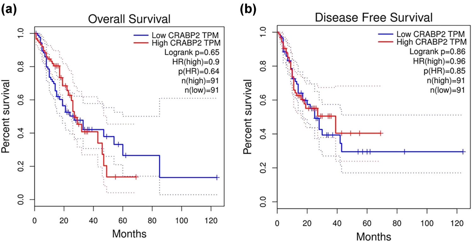 Figure 2 
                  (a) Analysis of the overall survival of patients with esophageal cancer with different expression levels of CRABP2 in the GEO database. (b) Analysis of the disease free survival of patients with esophageal cancer with different expression levels of CRABP2 in the GEO database.
               