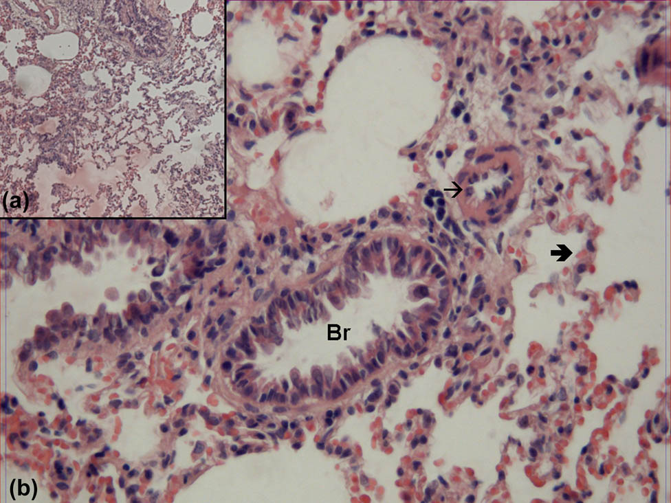 Figure 1 
                  Hematoxylin–eosin-stained lung samples obtained from the SHAM group. Br: bronchioles, : alveoli, →: vessel (hematoxylin–eosin, A: ×100, B: ×400).
               