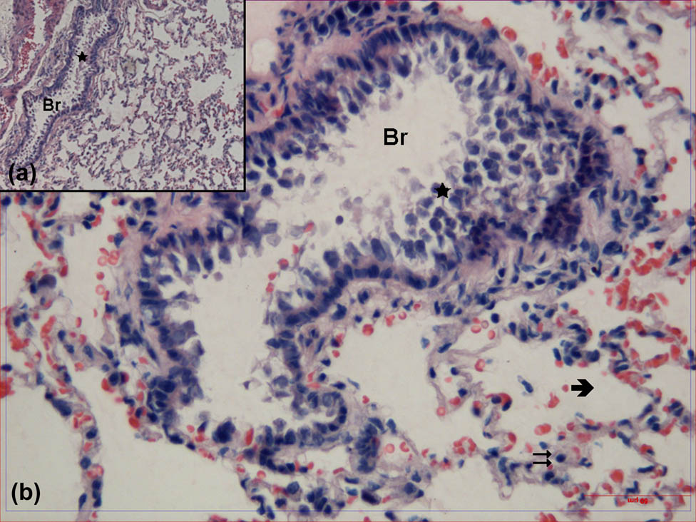 Figure 2 
                  Hematoxylin–eosin-stained lung tissue samples obtained from the group treated with physiological saline. Br: bronchioles, : alveoli, : interalveolar septa, : cell debris (hematoxylin–eosin, A: ×100, B: ×400).
               