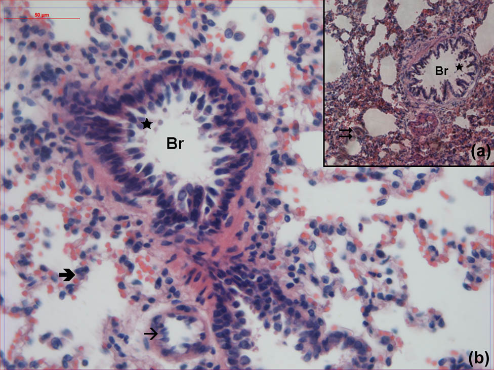 Figure 3 
                  Hematoxylin–eosin-stained lung samples obtained from the propofol-treated group. Br: bronchioles, : alveoli, : interalveolar septa, : cell debris, →: vessel (hematoxylin–eosin, A: ×100, B: ×400).
               
