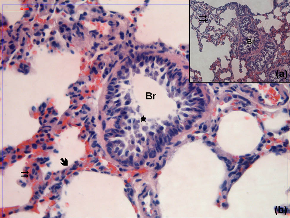 Figure 4 
                  Hematoxylin–eosin-stained lung samples obtained from the group treated with remifentanil. Br: bronchioles, : alveoli, : interalveolar septa, : cell debris (hematoxylin–eosin, A: ×100, B: ×400).
               