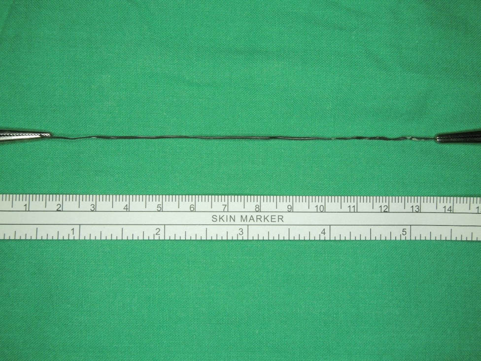 Figure 5 
               The retrieved specimen from RIRS (12 cm).
            