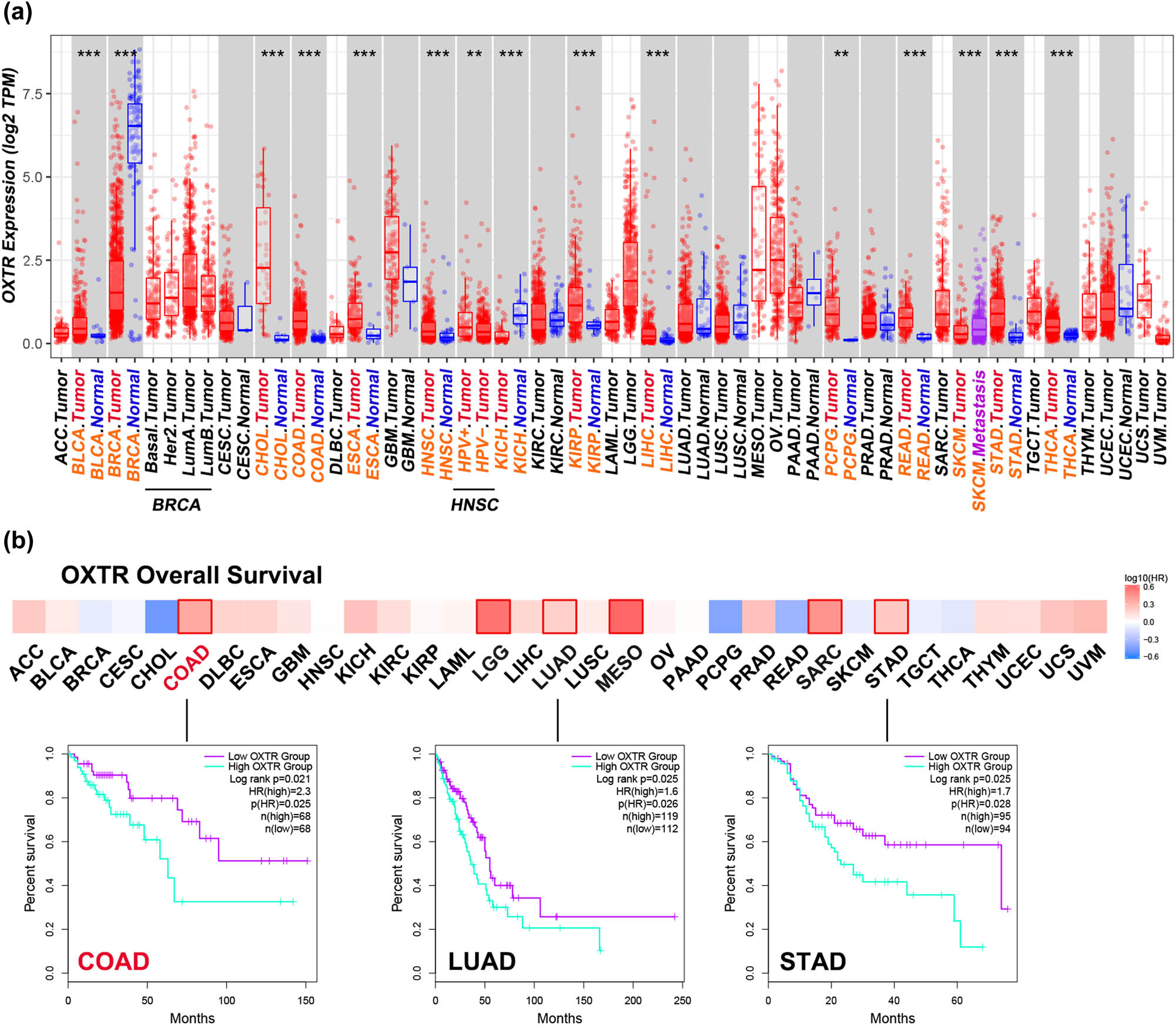 Figure 1 
                  Analysis of OXTR expression in various tumor tissues in TCGA. (a) Transcriptional levels of OXTR in different tumor tissues and adjacent normal tissues. (b) The relationships between OXTR expression levels in various tumors and OS were analyzed by KM curve. COAD: low OXTR group: n = 68, high OXTR group: n = 68; LUAD: low OXTR group: n = 112, high OXTR group: n = 119; STAD: low OXTR group: n = 94, high OXTR group: n = 95. ACC: adrenocortical carcinoma; BLCA: bladder urothelial carcinoma; BRCA: breast invasive carcinoma; CESC: cervical squamous cell carcinoma and endocervical adenocarcinoma; CHOL: cholangiocarcinoma; COAD: colon adenocarcinoma; DLBC: lymphoid neoplasm diffuse large B-cell lymphoma; ESCA: esophageal carcinoma; GBM: glioblastoma multiforme; HNSC: head and neck squamous cell carcinoma; HPV: human papillomavirus; KICH: kidney chromophobe; KIRC: kidney renal clear cell carcinoma; KIRP: kidney renal papillary cell carcinoma; LAML: acute myeloid leukemia; LGG: brain lower grade glioma; LIHC: liver hepatocellular carcinoma; LUAD: lung adenocarcinoma; LUSC: lung squamous cell carcinoma; MESO: mesothelioma; OV: ovarian serous cystadenocarcinoma; PAAD: pancreatic adenocarcinoma; PCPG: pheochromocytoma and paraganglioma; PRAD: prostate adenocarcinoma; READ: rectum adenocarcinoma; SARC: sarcoma; SKCM: skin cutaneous melanoma; STAD: stomach adenocarcinoma; TGCT: testicular germ cell tumors; THCA: thyroid carcinoma; THYM: thymoma; UCEC: uterine corpus endometrial carcinoma; UCS: uterine carcinosarcoma; UVM: uveal melanoma; LumA: luminal A; LumB: luminal B; Her2: human epidermal growth factor receptor-2. **: p < 0.01; ***: p < 0.001.
               