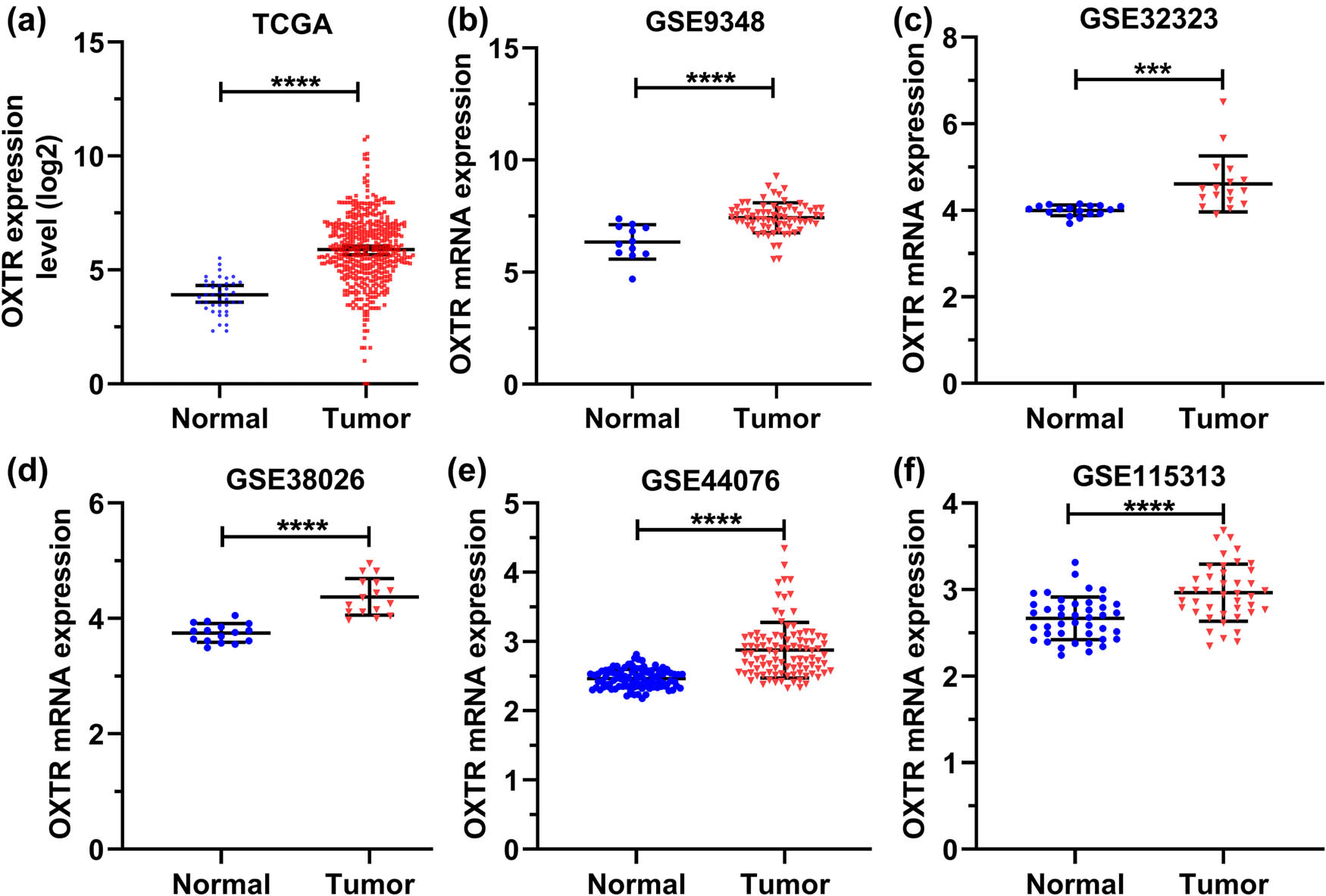 Figure 2 
                  OXTR mRNA level is high in COAD patients from six datasets. (a–f) GraphPad Prism 8 was used to analyze the expression of OXTR in COAD samples from TCGA (a), GSE9348 (b), GSE32323 (c), GSE38026 (d), GSE44076 (e), and GSE115313 (f) databases. ***: p < 0.001; ****: p < 0.0001.
               