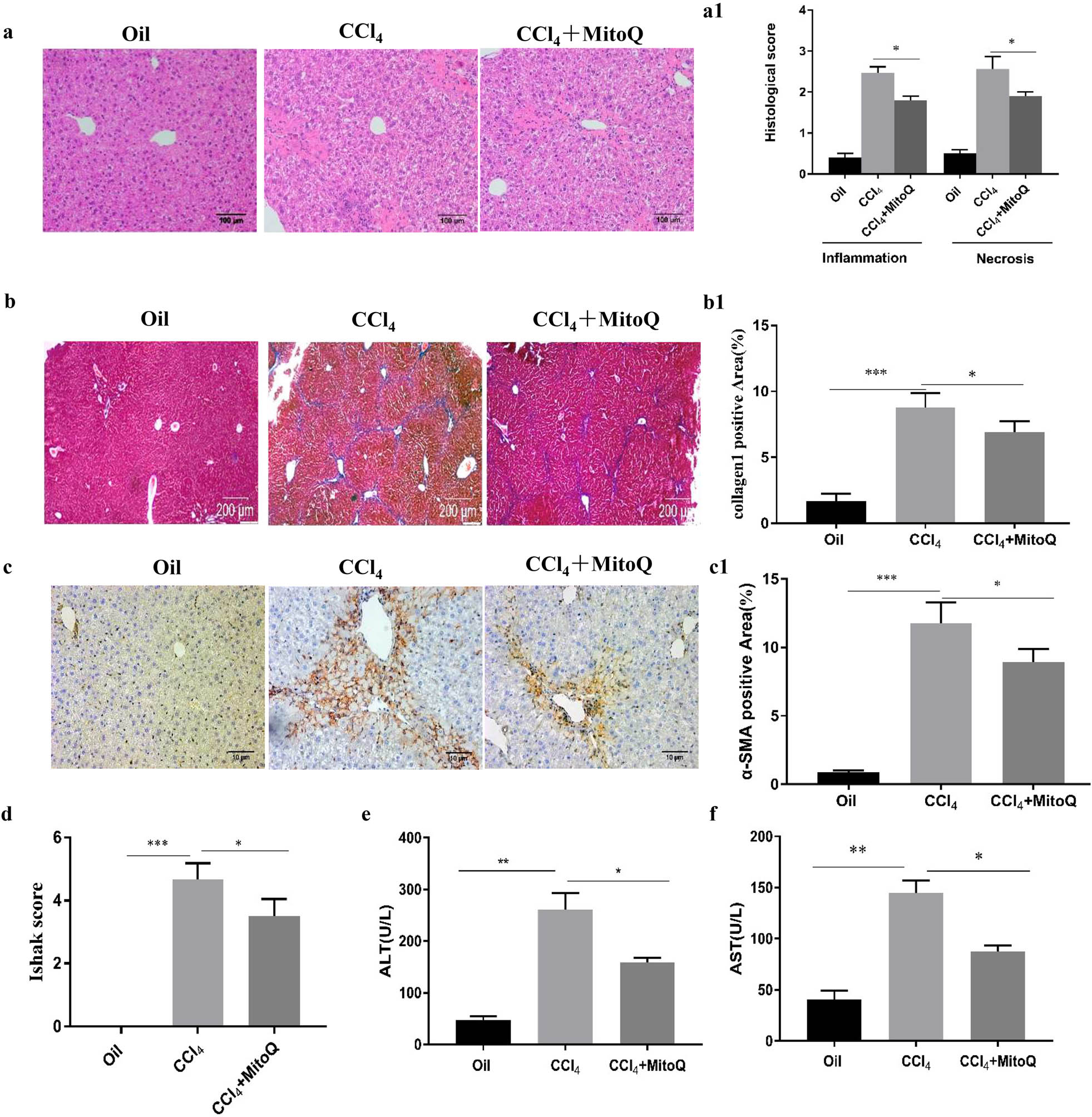 Figure 1 
                  MitoQ inhibits mouse hepatic fibrosis. (a) Representative images of hematoxylin and eosin (HE) staining of liver tissue (100× magnification). (a1) Quantification of liver inflammation and injury was performed. Results are presented as mean ± standard deviation. *P < 0.05 indicates significant differences relative to the indicated groups; (n = 6). (b) Masson’s trichrome staining of the liver tissue (40× magnification); (n = 6). (b1) Columns represent the percentage of positive area of collagen fibers. Results are presented as mean ± standard deviation. *P < 0.05, ***P < 0.001 (n = 6). (c) Immunohistochemistry for α-SMA in the liver tissue (100× magnification). (c1) Columns represent the percentage of α-SMA positive area. Results are presented as mean ± standard deviation. *P < 0.05, ***P < 0.001 (n = 6). (d) Liver fibrosis semiquantitative scoring was performed. *P < 0.05, ***P < 0.001; (n = 6). (e) Serum ALT levels. *P < 0.05, **P < 0.01 (n = 6). (f) Serum AST levels. *P < 0.05, **P < 0.01 (n = 6).
               