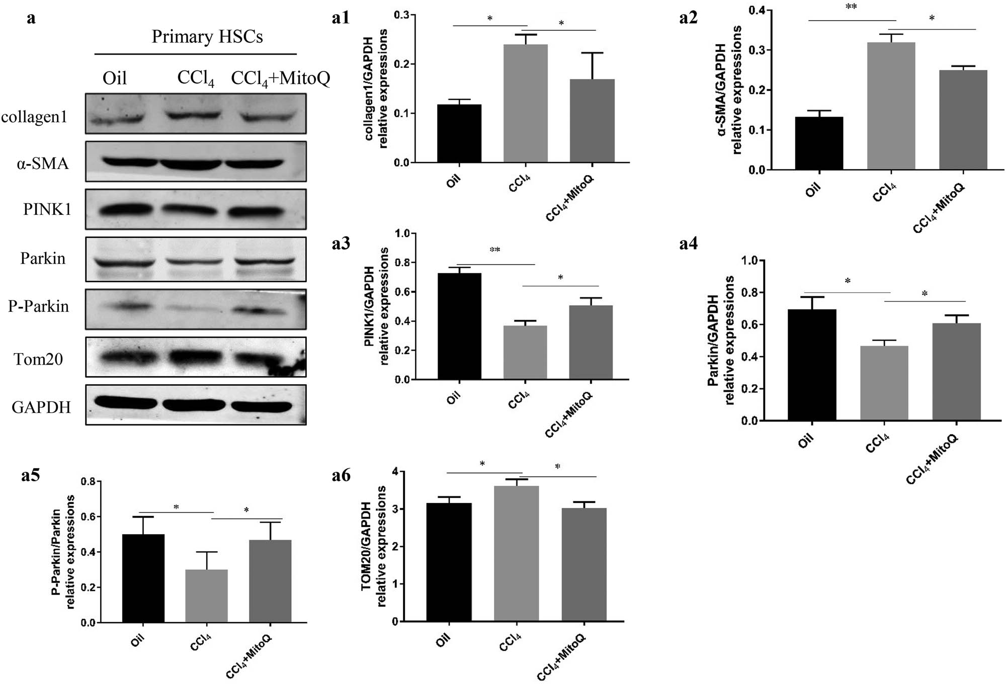 Figure 2 
                  Mitophagy decreases with the activation of HSCs, and MitoQ enhances mitophagy. (a) Western blot analysis shows the collagen 1, α-SMA, PINK1, parkin, P-parkin, and TOM20 expression in the primary HSCs. (a1) Columns represent the gray-scale value of collagen 1 expression. (a2) Columns represent the gray-scale value of the α-SMA expression. (a3) Columns represent the gray-scale value of PINK1 expression. (a4) Columns represent the gray-scale value of parkin expression. (a5) Columns represent the gray-scale value of P-parkin expression. (a6) Columns represent the gray-scale value of TOM20 expression. Data show the mean ± standard deviation. Experiments were repeated three times. *P < 0.05, and **P < 0.01.
               