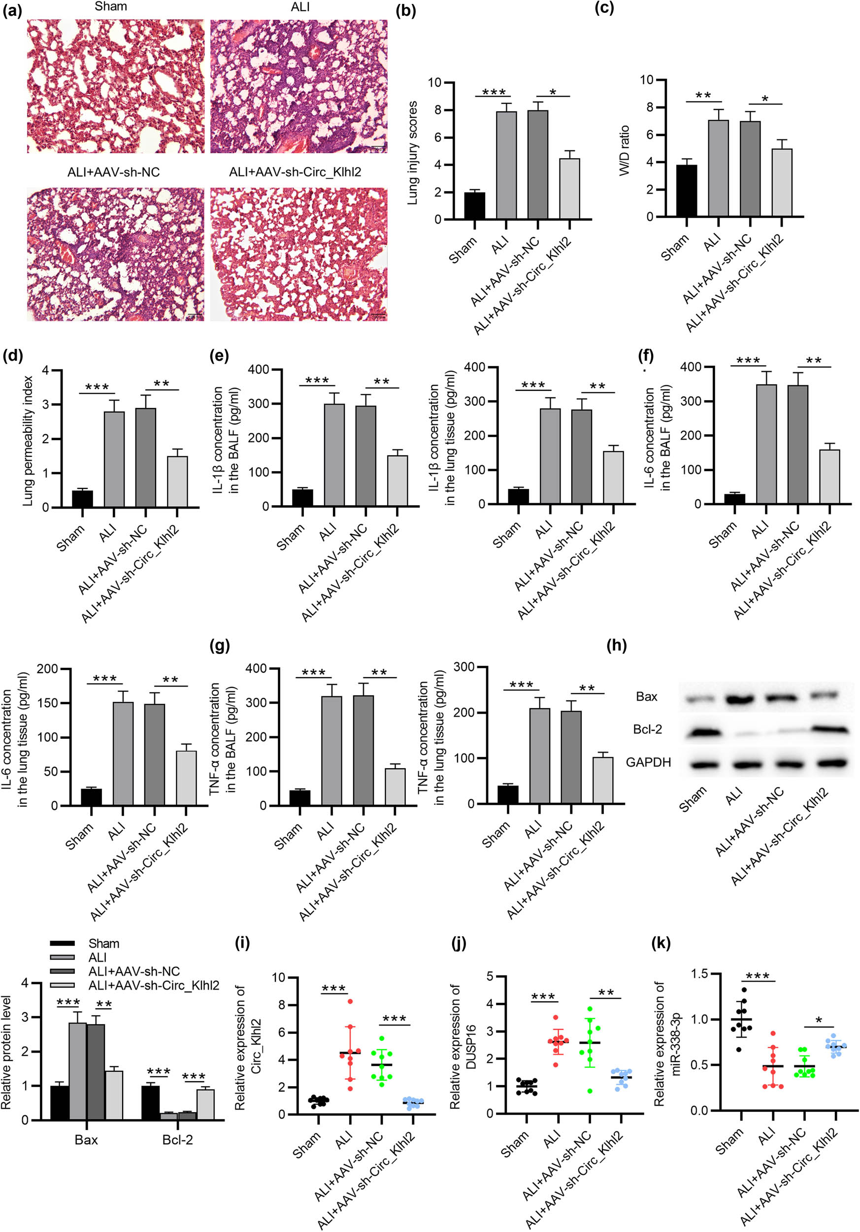 Figure 5 
                  Circ_0001679 knockdown alleviates lung injury and reduces inflammation in ALI mice. (a) The histological changes in lungs of ALI mice and sham mice were analyzed by hematoxylin and eosin staining. (b) Lung injury scores were analyzed and recorded. (c) Lung W/D ratio of mice and (d) lung permeability index in the lung tissues. (e–g) ELISA of the concentrations of IL-1β, IL-6, and TNF-α in the BALF and the lung tissues in each group. (h) Western blot analysis of the Bax and Bcl-2 protein levels in the lung tissues in each group. RT-qPCR analysis of (i) circ_0001679 expressions, (j) DUSP16 expression, and (k) miR-338-3p expression in the lung tissues in each group. (l–n) Pearson correlation analysis of the expression relationship between circ_0001679, DUSP16, and miR-338-3p in ALI mouse lung tissues. N = 12 per group. Data are shown as the mean value ± SD. The experiments were repeated three times. *p < 0.05, **p < 0.01, and ***p < 0.001.
               