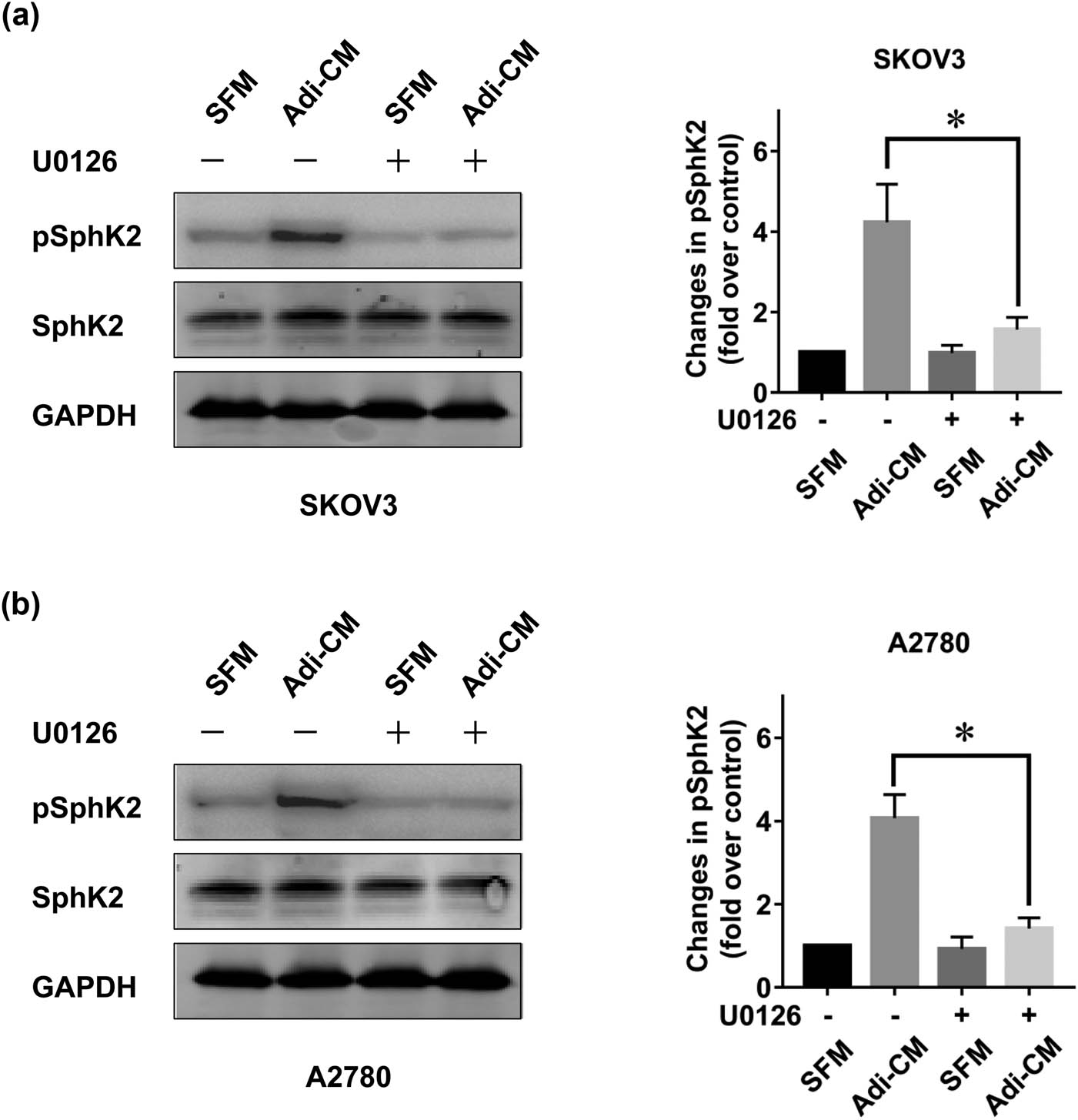 Figure 3 
                  Adipocyte-induced SphK2 activation is ERK dependent. (a) SKOV3 and (b) A2780 cells were serum starved overnight and pretreated with U0126 (5 μM) for 2 h. Cells were then cultured with SFM or Adi-CM for 24 h. Total and phosphorylated SphK2 (pSphK2) levels were then determined by using Western blot. Right panels show the densitometric analysis of pSphK2 (normalized to total SphK2) corresponding to the bands shown in the Western blots. Molecular weight of pSphK2 is 70 kDa, molecular weight of SphK2 is 69 kDa, and molecular weight of GAPDH is 36 kDa. Data are the mean ± SD. *, P < 0.05.
               