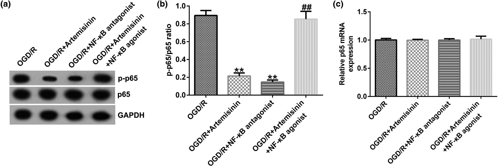 Figure 8 
                     NF-κB agonist reverses the inhibitory effect of ART on the NF-κB signaling pathway in OGD/R-exposed SH-SY5Y cells. SH-SY5Y cells were pre-treated with 100 μM ART, an NF-κB antagonist, or 100 μM ART + NF-κB agonist for 2 h and then exposed to OGD/R. (a) Protein expressions of p-p65 and p65 were measured using western blotting. (b) p-p65/p65 ratio. (c) mRNA expression of p65 was determined via RT-qPCR. **p < 0.01 vs OGD/R; ##
                        p < 0.05, 0.01 vs OGD/R + ART.
                  