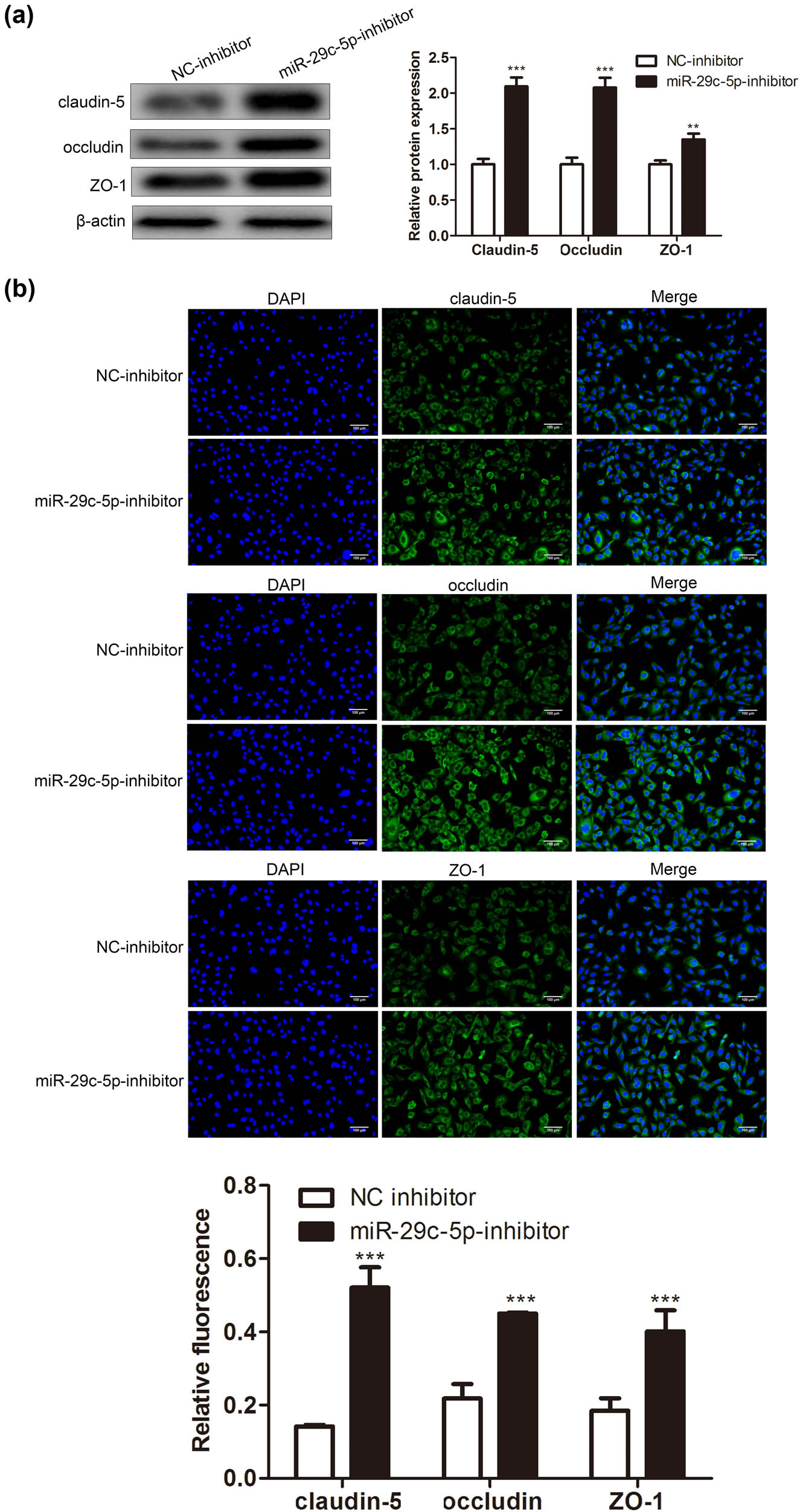 Figure 3 
                  Influence of miR-29c-5p on the TJP destruction of BMECs caused by OGD-treated astrocytes. Astrocytes transfected with miR-29c-5p inhibitor or NC-inhibitor were treated with OGD for 3 h, and the cells were cocultured with BMECs for 24 h. (a) The protein levels of TJPs claudin-5, occludin, and ZO-1 were determined using Western blot. (b) Immunofluorescence staining assay was applied to quantify the claudin-5, occludin, and ZO-1 expressions (scale bar: 100 µm). Data are presented as an average of three independent assays. **P < 0.01, ***P < 0.001 vs NC-inhibitor.
               