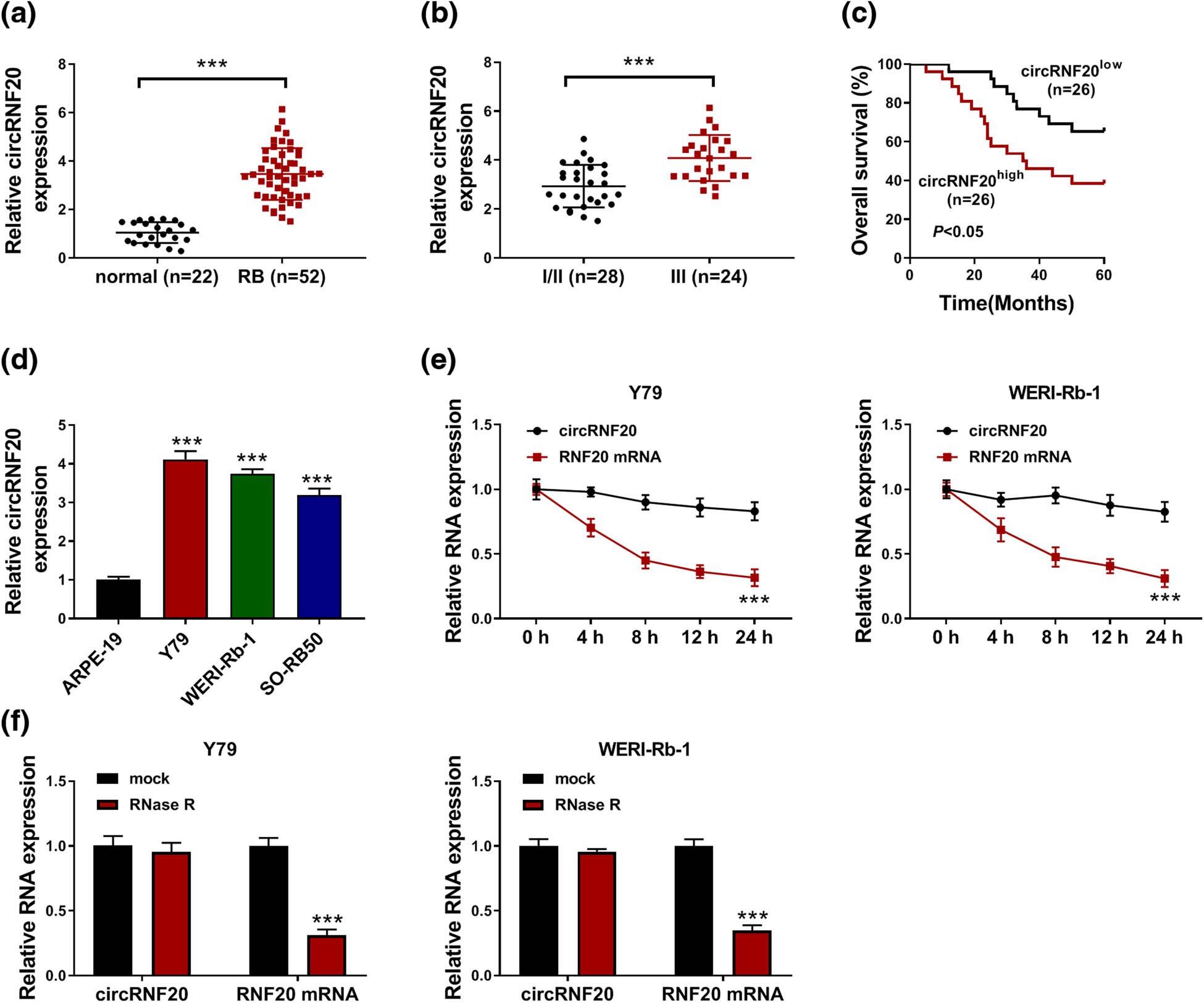 circRNF20 aggravates the malignancy of retinoblastoma