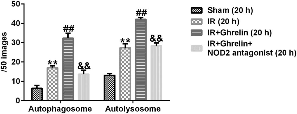 Figure 3 
                  The number of autophagosomes and autolysosomes in the intestinal epithelium of rats. The number of autophagosomes and autolysosomes in the IR group, the ghrelin-treated group, the ghrelin and NOD2 antagonist treatment group, and the sham group at 20 h after I/R. Data were expressed as mean ± SD, n = 6; **P < 0.01 vs. sham; ##
                     P < 0.01 vs. IR; and P < 0.01 vs. IR + ghrelin.
               