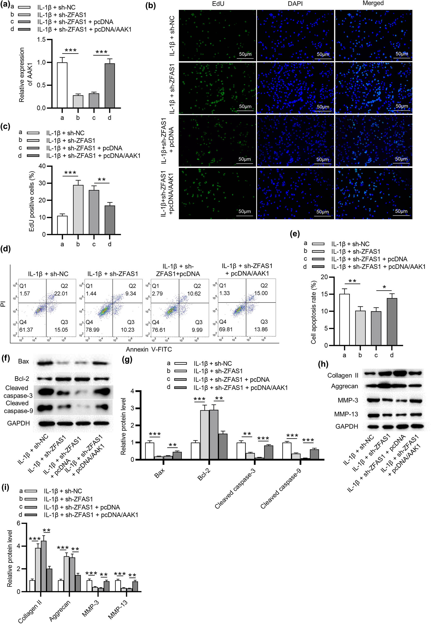 Figure 4 
                  ZFAS1 facilitates NP cell apoptosis and ECM degradation by AAK1. NP cells were then treated with IL-1β + sh-NC, IL-1β + sh-ZFAS1, IL-1β + pcDNA, and IL-1β + pcDNA/AAK1M, respectively. (a) AAK1 expression in NP cells. (b and c) EdU assay of cell proliferation in each group. (d and e) Flow cytometry analysis of cell apoptosis in each group. (f–i) Western blotting analysis of the expression of Bax, Bcl-2, Collagen II, Aggrecan, MMP-3, and MMP-13 in each group. *
                     p < 0.05, **
                     p < 0.01, ***
                     p < 0.001.
               
