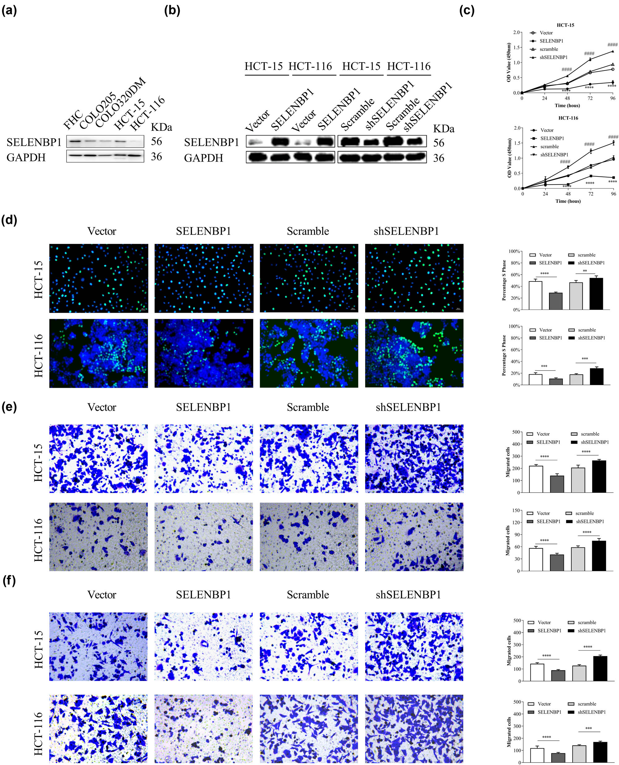 Figure 4 
                  SELENBP1 inhibits cell proliferation, migration, and invasion of cultured CRC cells. The expression of SELENBP1 protein was determined in a fetal colon cell line FHC and several CRC cell lines (a). SELENBP1 was inducibly overexpressed and silenced in HCT-15 and HCT-116 cells (b). The in vitro effects of SELENBP1 on cell proliferation, migration, and invasion were evaluated by CCK-8 (c), Edu (d), Transwell migration (e), and invasion (f) assays, respectively. Experiments were repeated independently at least three times, and data are expressed as mean ± SEM (n = 3). *p < 0.05; **
                     p < 0.01; ***
                     p < 0.001; ****
                     p < 0.0001 vs the control group; ####
                     p < 0.0001 vs the control group (for shSELENBP1 vs scramble in the CCK-8 assays only).
               