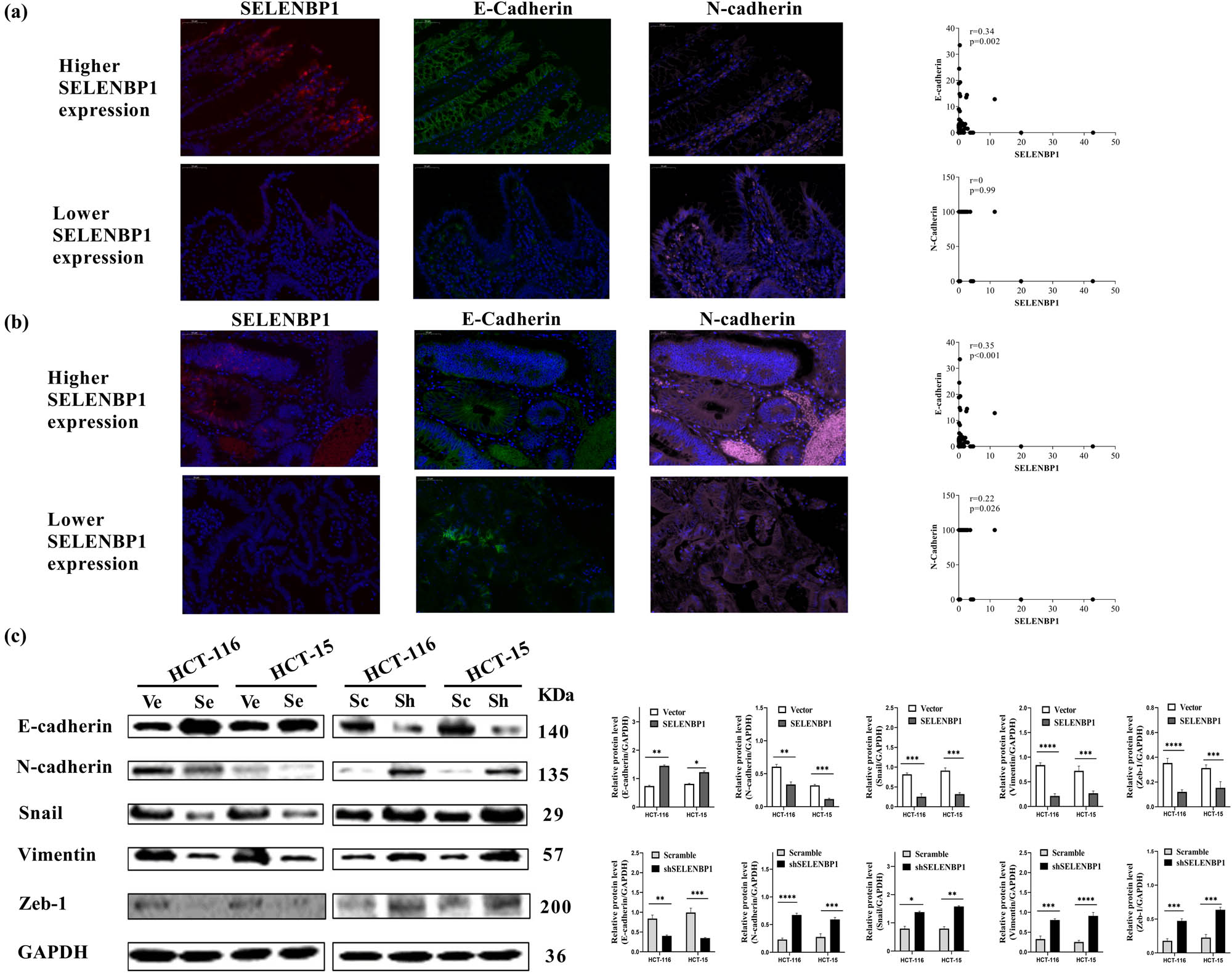 Figure 5 
                  SELENBP1 inhibits EMT in CRC cells. A multicolor IF staining method was used to evaluate the expression and localization of SELENBP1 (red), E-cadherin (green), and N-cadherin (pink) in NTs (a) and CRCs (b), using the TMA cohort (scale bar = 50 μm). Percent of positive cells were calculated and correlation analyses were conducted based on the expression of these proteins (scatter plots on the right). Total proteins were extracted from HCT-15 and HCT-116 cells stably infected with SELENBP1, shSELENBP1, or relative control lentiviruses and were used to evaluate the expression of EMT markers and transcription factors by WB with GAPDH as a loading control (c). Experiments were repeated independently at least three times, and data are expressed as mean ± SEM (n = 3). *p < 0.05; **p < 0.01; ***p < 0.001; ****p < 0.0001 vs the control group.
               