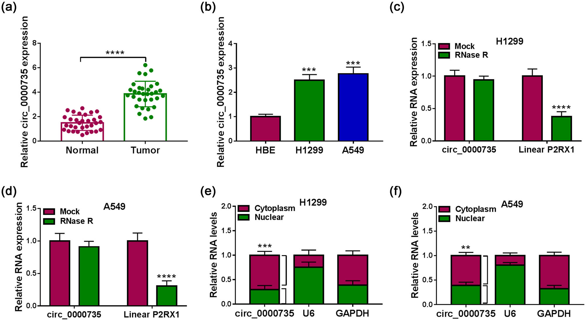 Figure 2 
                  circ_0000735 was upregulated in NSCLC. (a and b) Relative expression of circ_0000735 in NSCLC tissues (n = 32) and cells (n = 3) was detected using RT-qPCR. (c and d) Relative expression of circ_0000735 in RNase R-digested NSCLC cell RNA was evaluated using RT-qPCR (n = 3). (e and f) After cell fractionation, the level of circ_0000735 in the nuclear and cytoplasmic fractions was analyzed using RT-qPCR (n = 3). U6 and GAPDH served as a positive control for nuclear and cytoplasmic fractions, respectively. ***P < 0.001 and ****P < 0.0001.
               