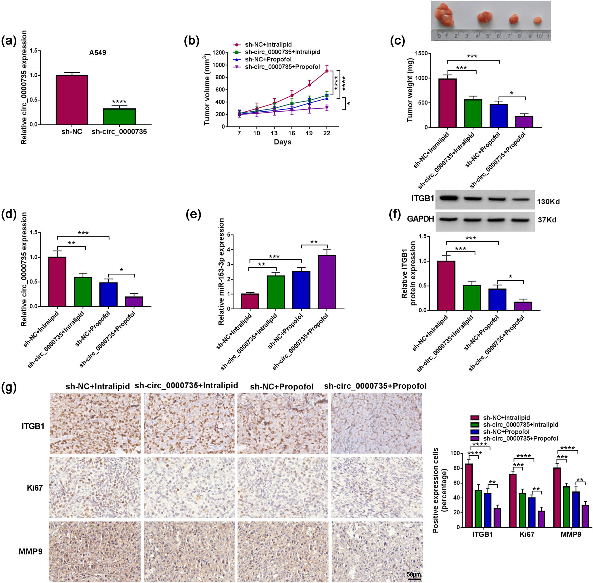 Figure 8 
                  Propofol decreased xenograft tumor growth via downregulating circ_0000735 in vivo. (a) RT-qPCR analysis of circ_0000735 in A549 cells carrying sh-circ_0000735 or sh-NC (n = 3). (b and c) Growth curves, representative images, and weights of xenograft tumors in sh-NC + intralipid, sh-circ_0000735 + intralipid, sh-NC + propofol, and sh-circ_0000735 + propofol groups (n = 8). (d and e) Analysis of circ_0017639, miR-153-3p, and ITGB1 in xenograft tumors derived from sh-NC + intralipid, sh-circ_0000735 + intralipid, sh-NC + propofol, and sh-circ_0000735 + propofol groups by RT-qPCR or western blotting (n = 3). (g) Analysis of ITGB1, Ki67, or MMP9 in xenograft tumors derived from sh-NC + intralipid, sh-circ_0000735 + intralipid, sh-NC + propofol, and sh-circ_0000735 + propofol groups using IHC (n = 3). *P < 0.05, **P < 0.01, ***P < 0.001, and ****P < 0.0001.
               