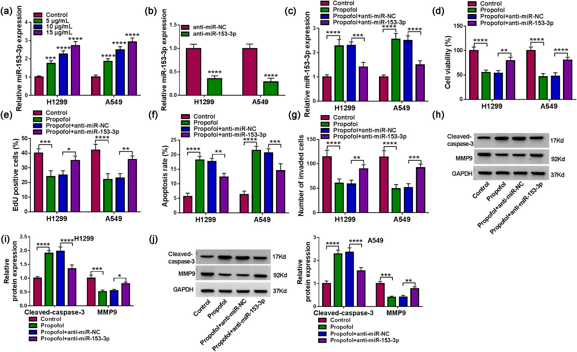 Figure A1 
               Overexpression of miR-153-3p lowered NSCLC cell malignancy. (a–d) The viability, proliferation, apoptosis, and invasion of NSCLC cells transfected with miR-NC or miR-153-3p were assessed by MTT, EdU, flow cytometry, and transwell assays (n = 3). ***P < 0.001 and ****P < 0.0001.
            